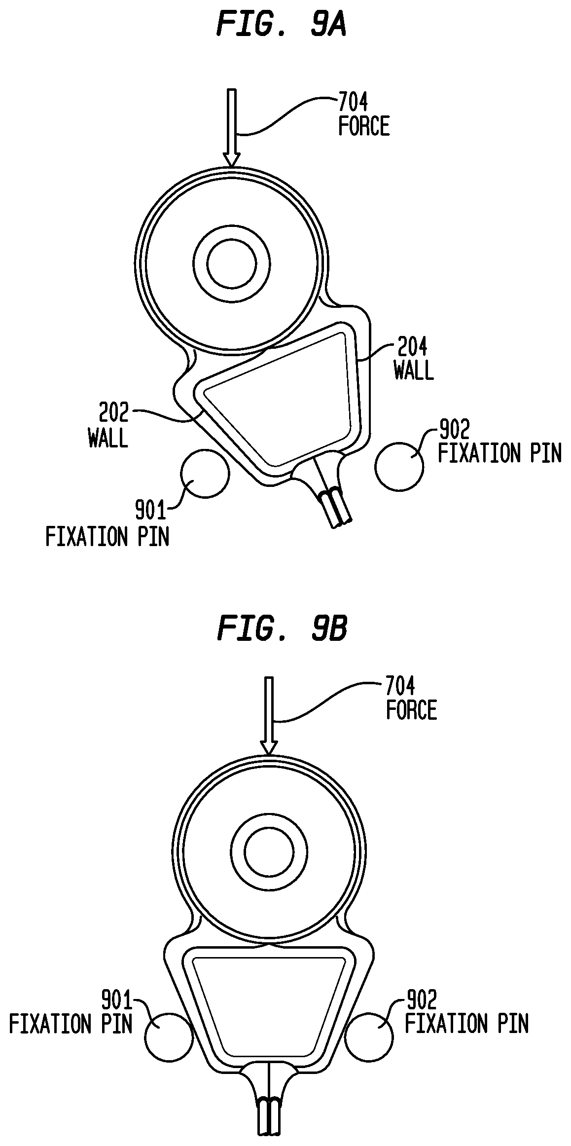 Patent US12318605 Figure 12 – Implantable device migration control
