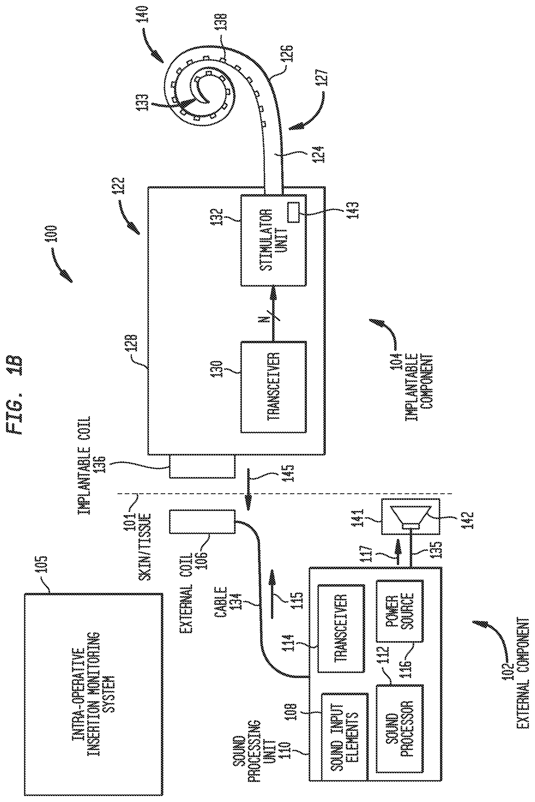 Patent US12318606 Figure 2 – Monitoring stimulating assembly insertion