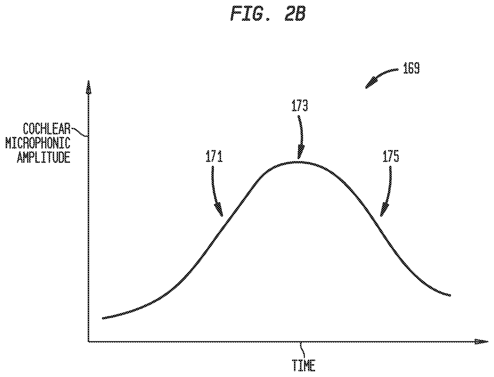 Patent US12318606 Figure 4 – Monitoring stimulating assembly insertion