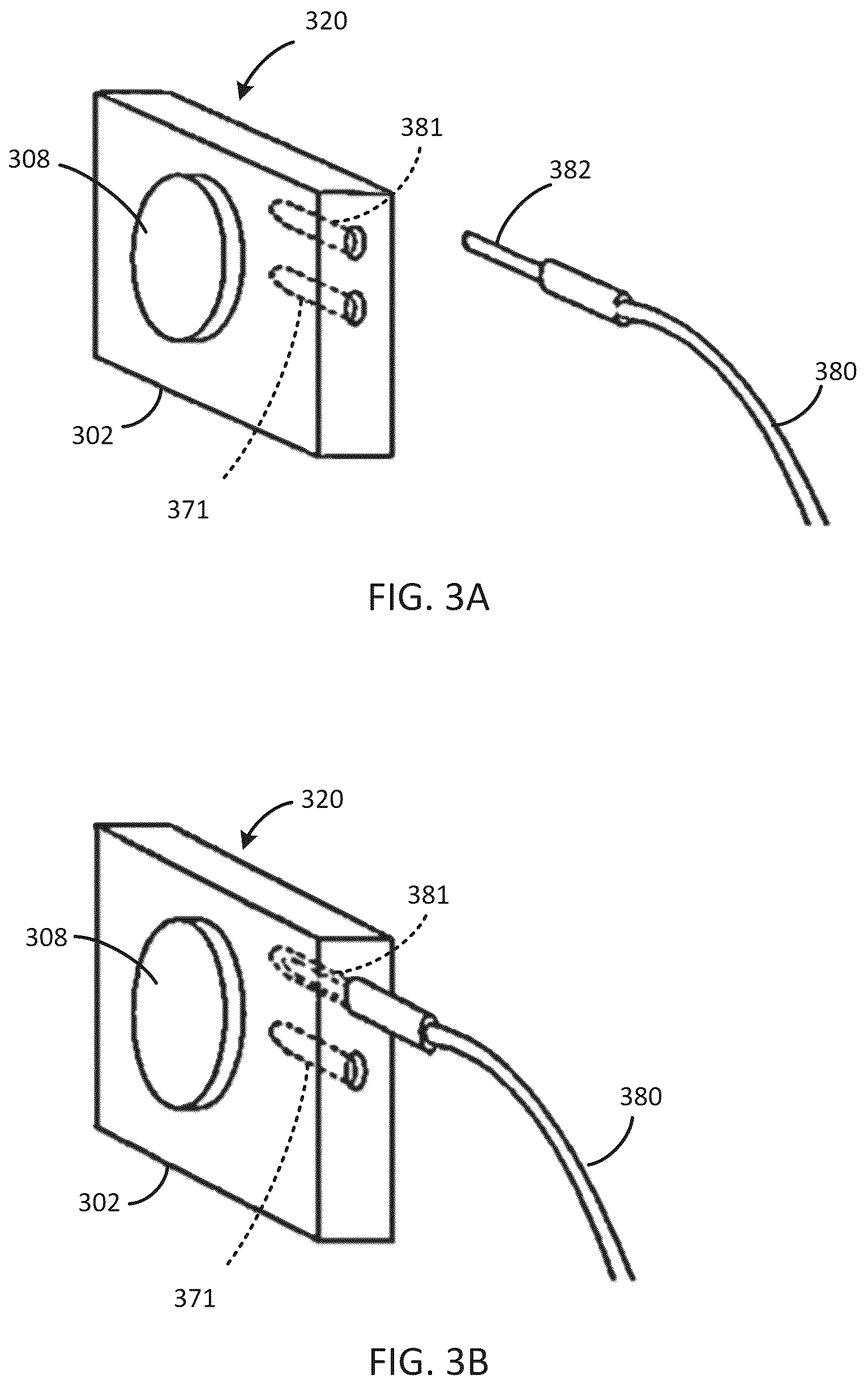 Patent US12318607 Figure 3 – Implantable cochlear system with integrated components and lead characterization
