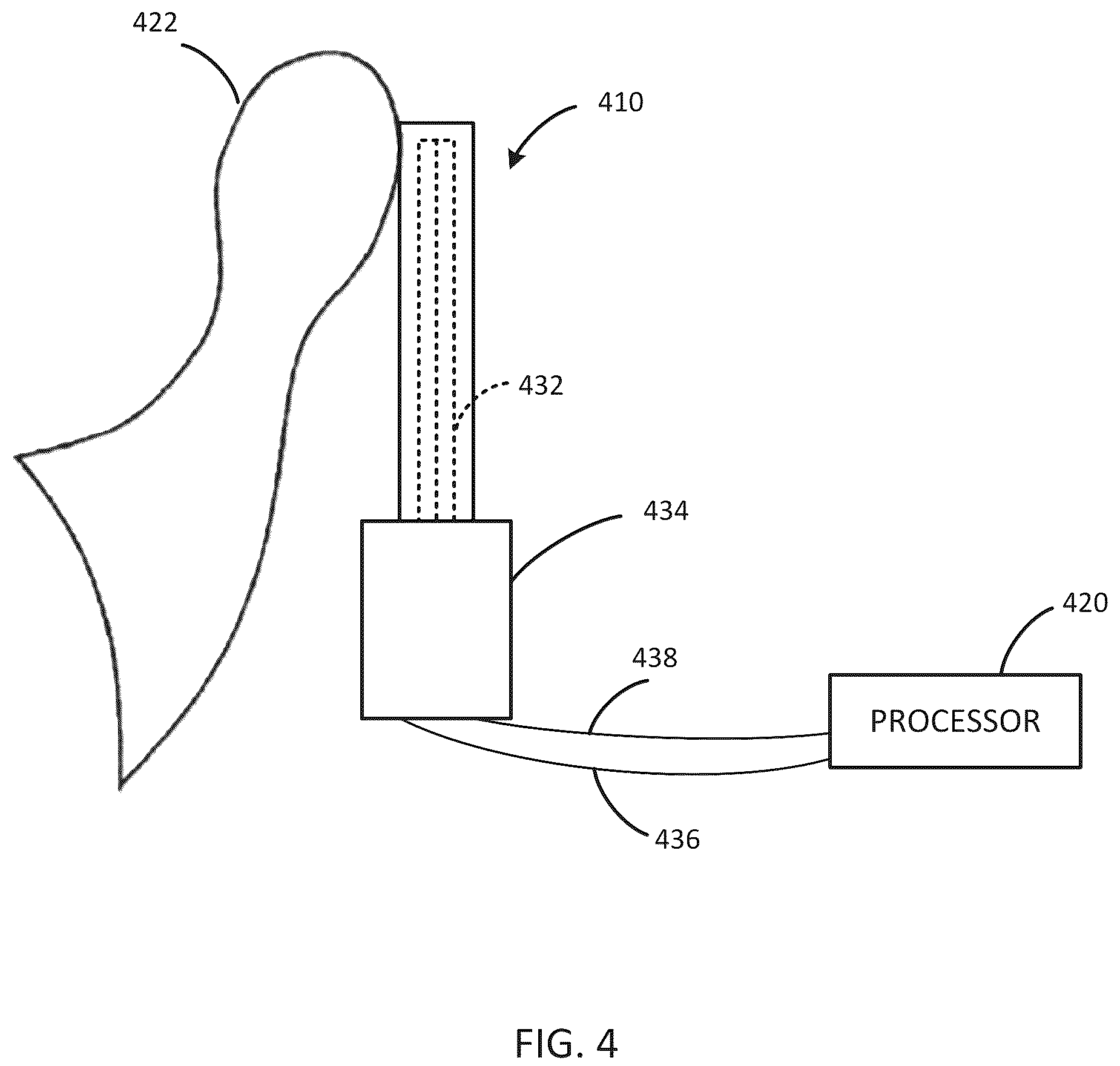 Patent US12318607 Figure 4 – Implantable cochlear system with integrated components and lead characterization