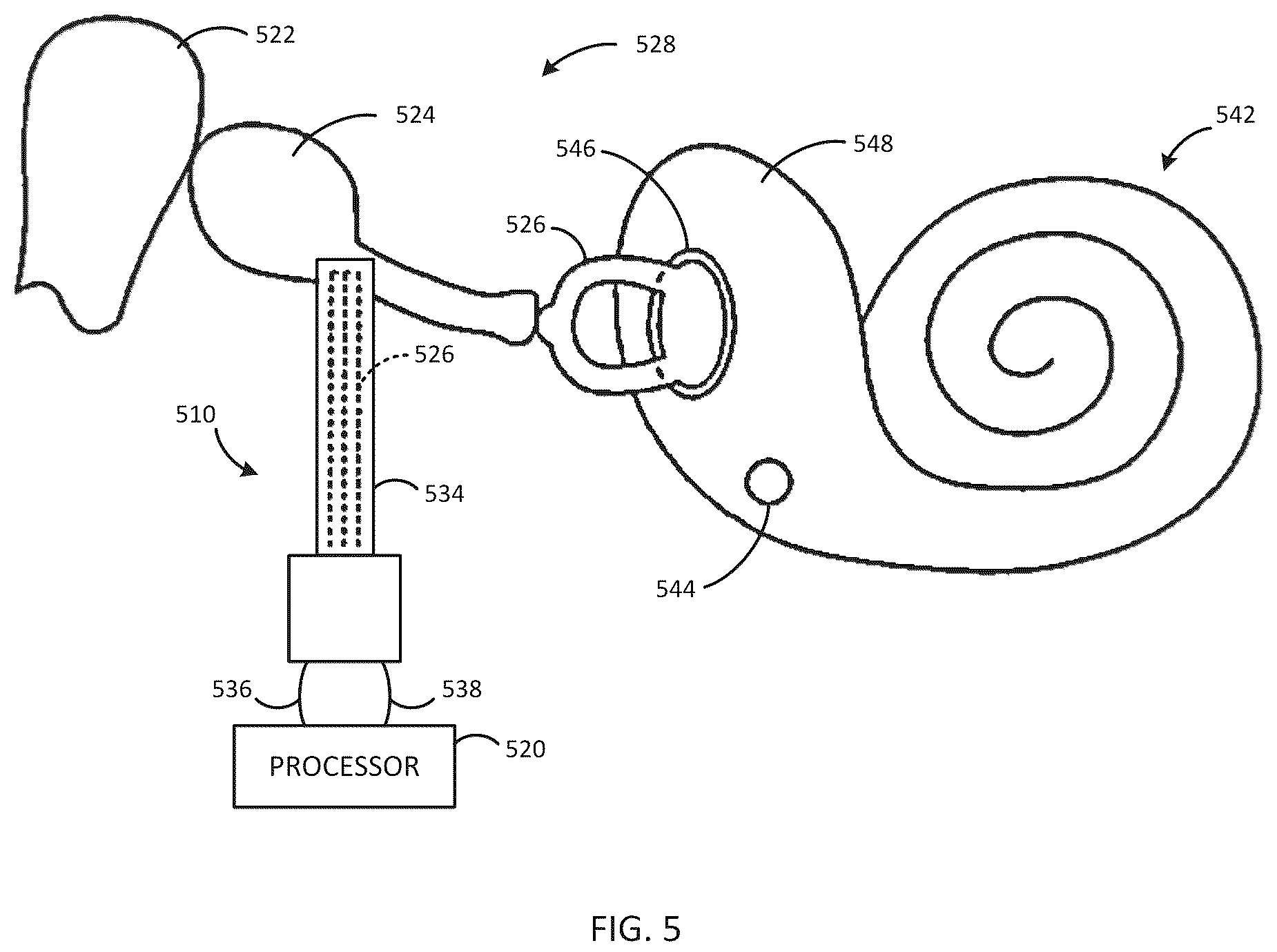Patent US12318607 Figure 5 – Implantable cochlear system with integrated components and lead characterization