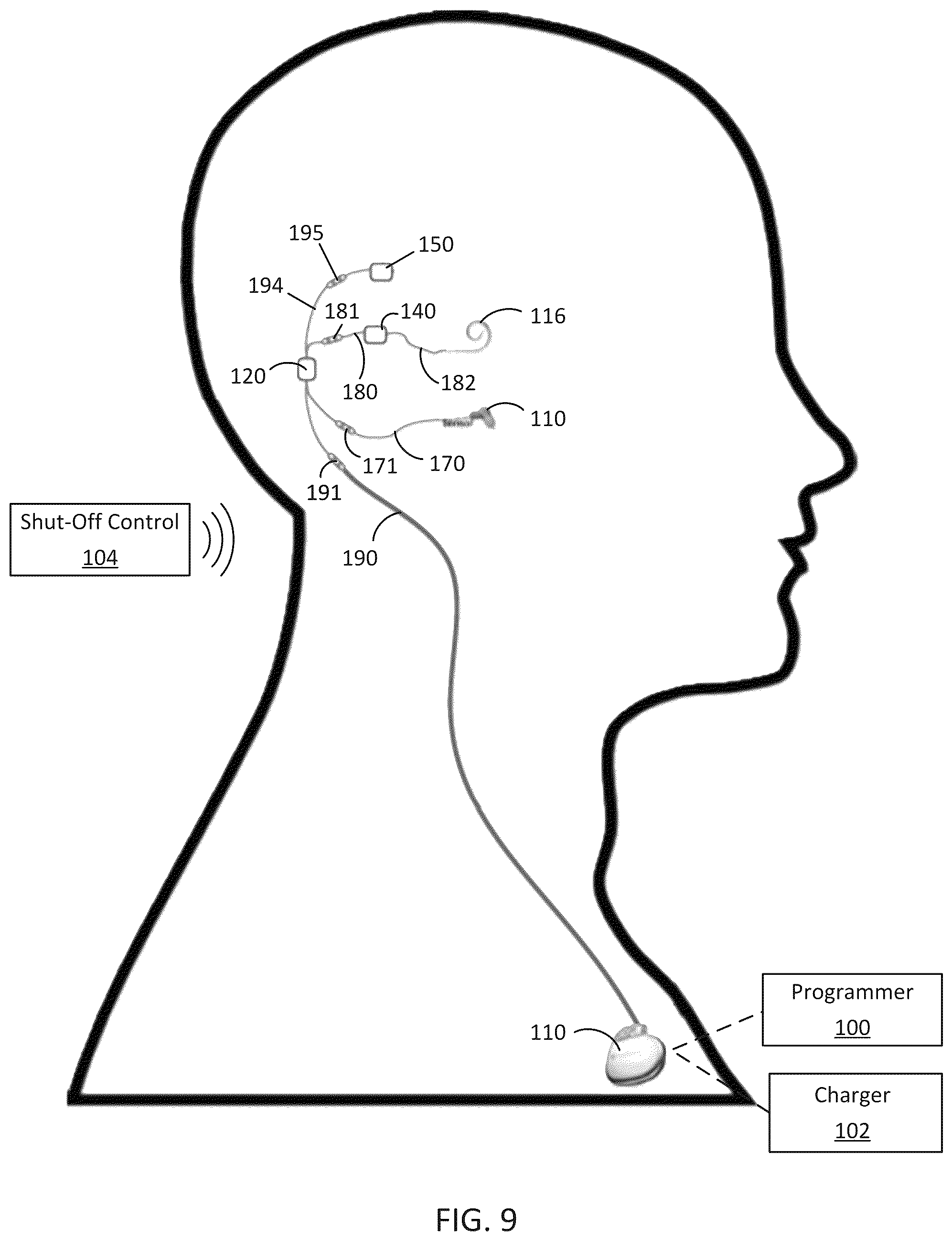 Patent US12318607 Figure 9 – Implantable cochlear system with integrated components and lead characterization
