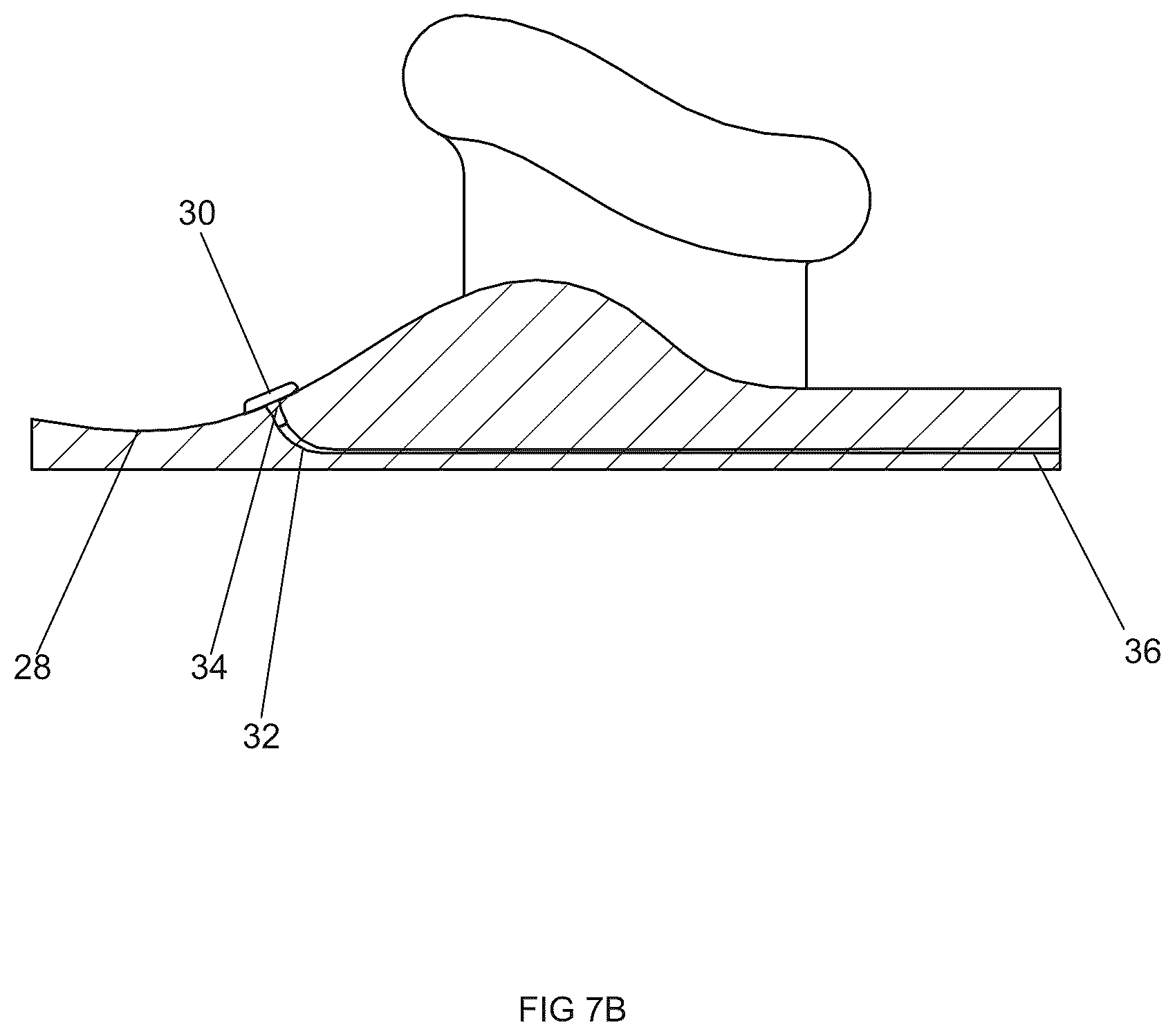 Patent US12318608 Figure 14 – Devices and methods for delivering neuroregenerative therapy