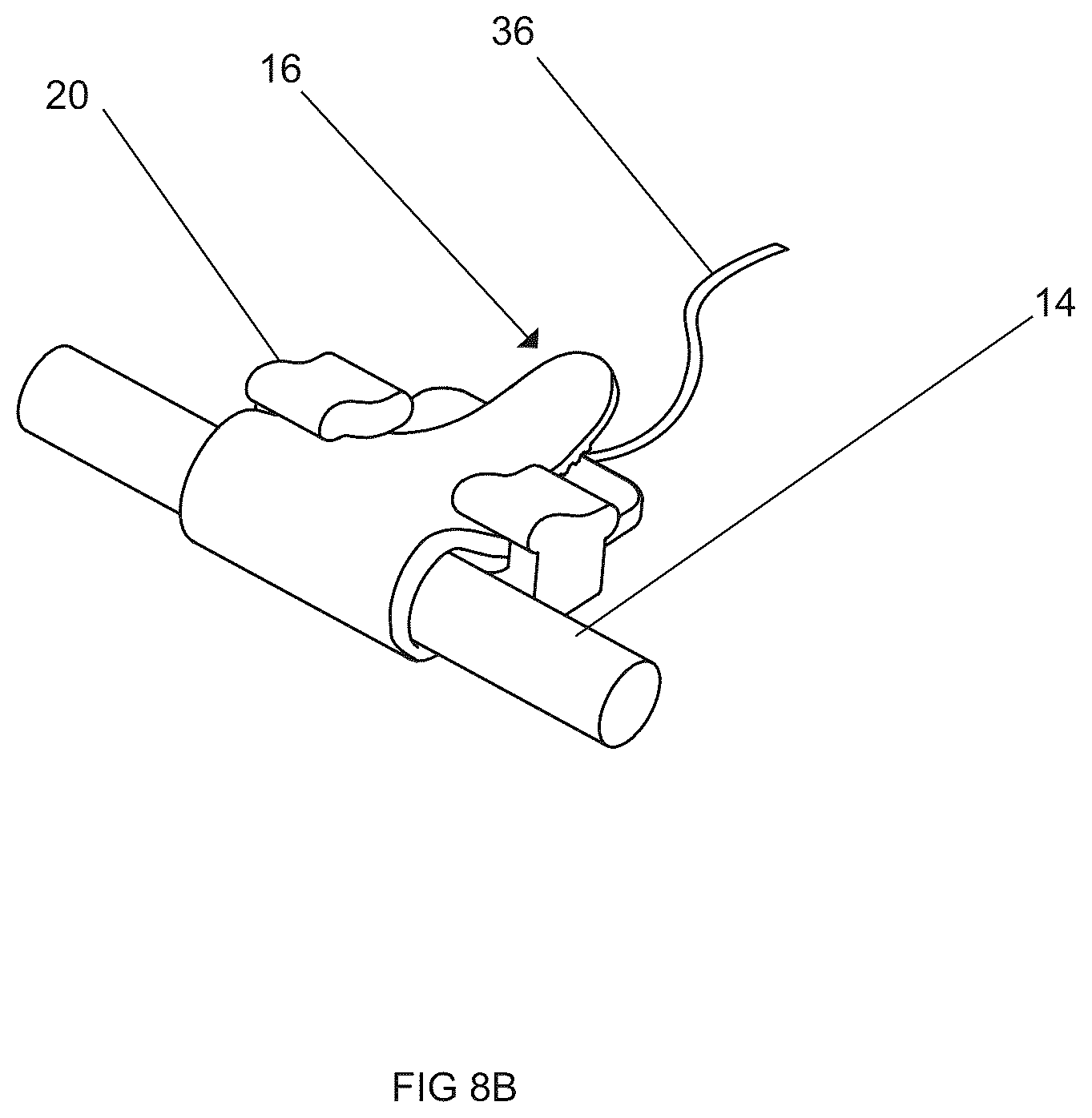 Patent US12318608 Figure 16 – Devices and methods for delivering neuroregenerative therapy