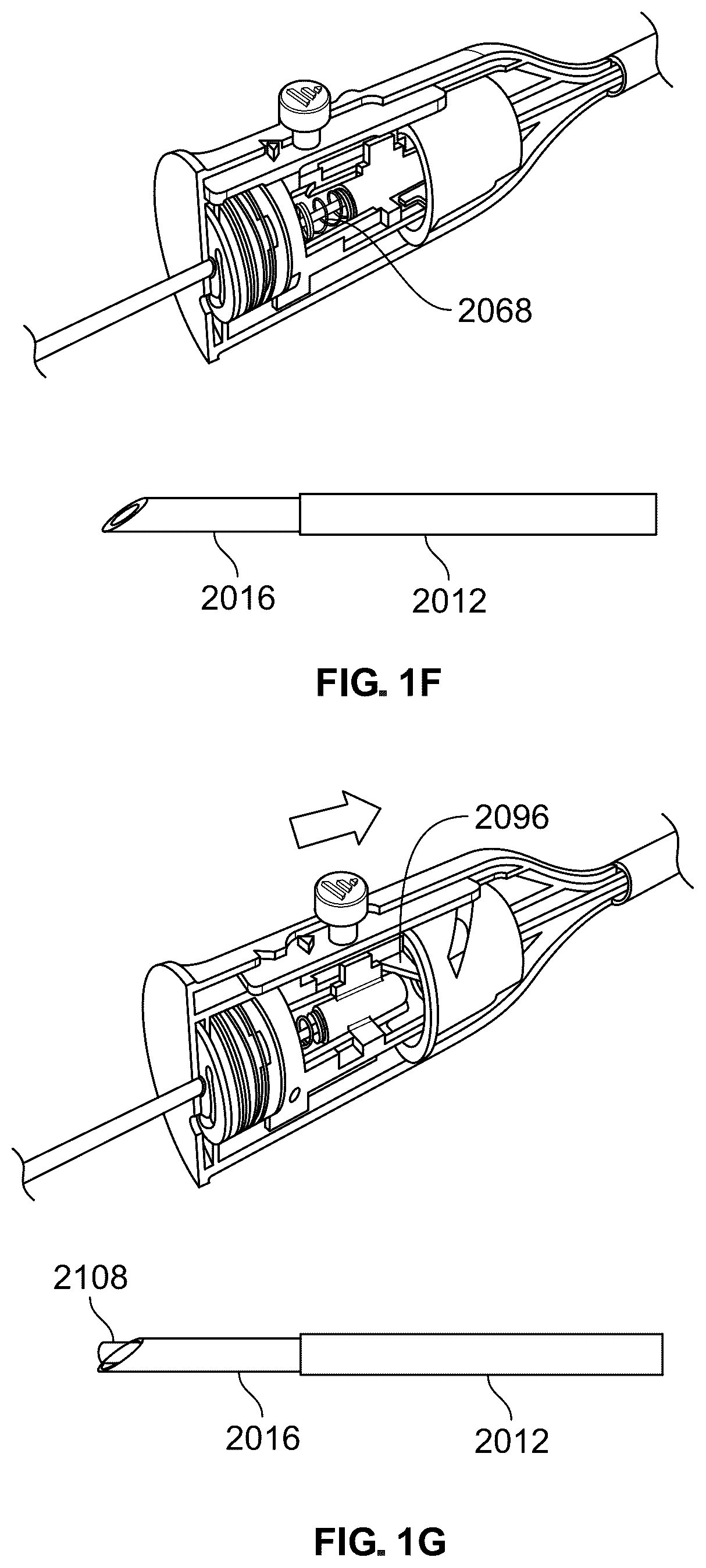 Patent US12318609 Figure 3 – Apparatus and method for positioning, implanting and using a stimulation lead