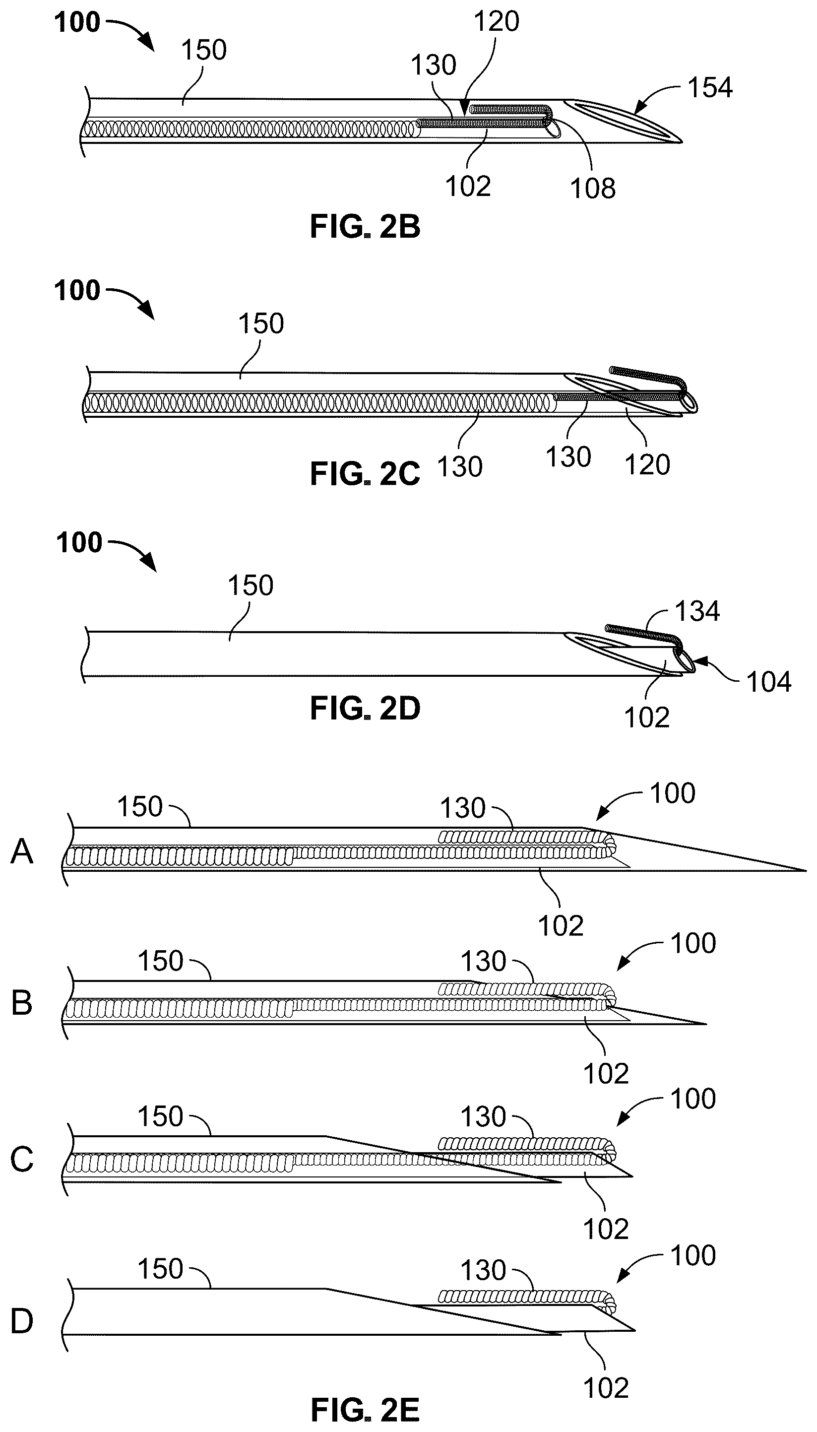 Patent US12318609 Figure 6 – Apparatus and method for positioning, implanting and using a stimulation lead