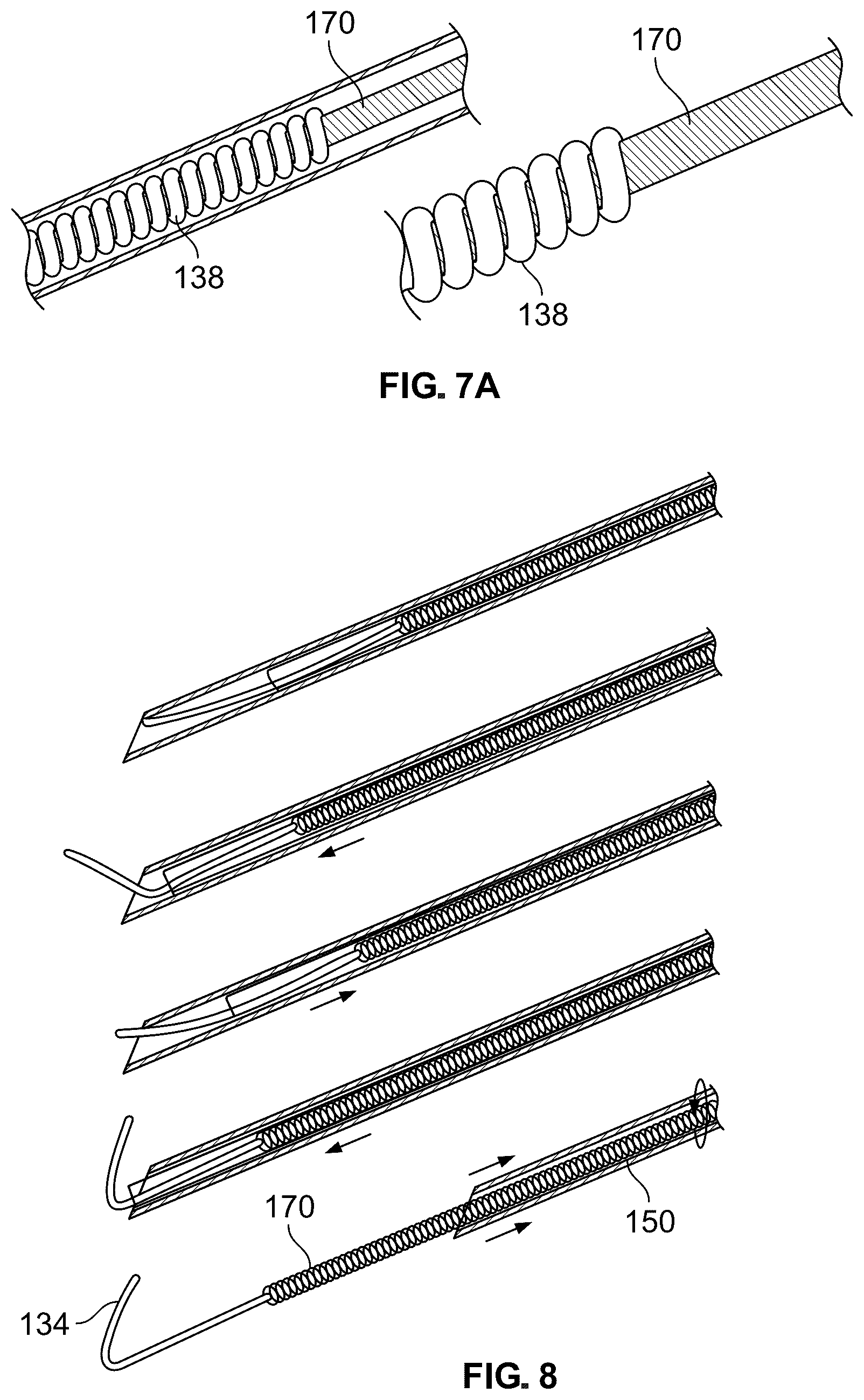 Patent US12318609 Figure 10 – Apparatus and method for positioning, implanting and using a stimulation lead