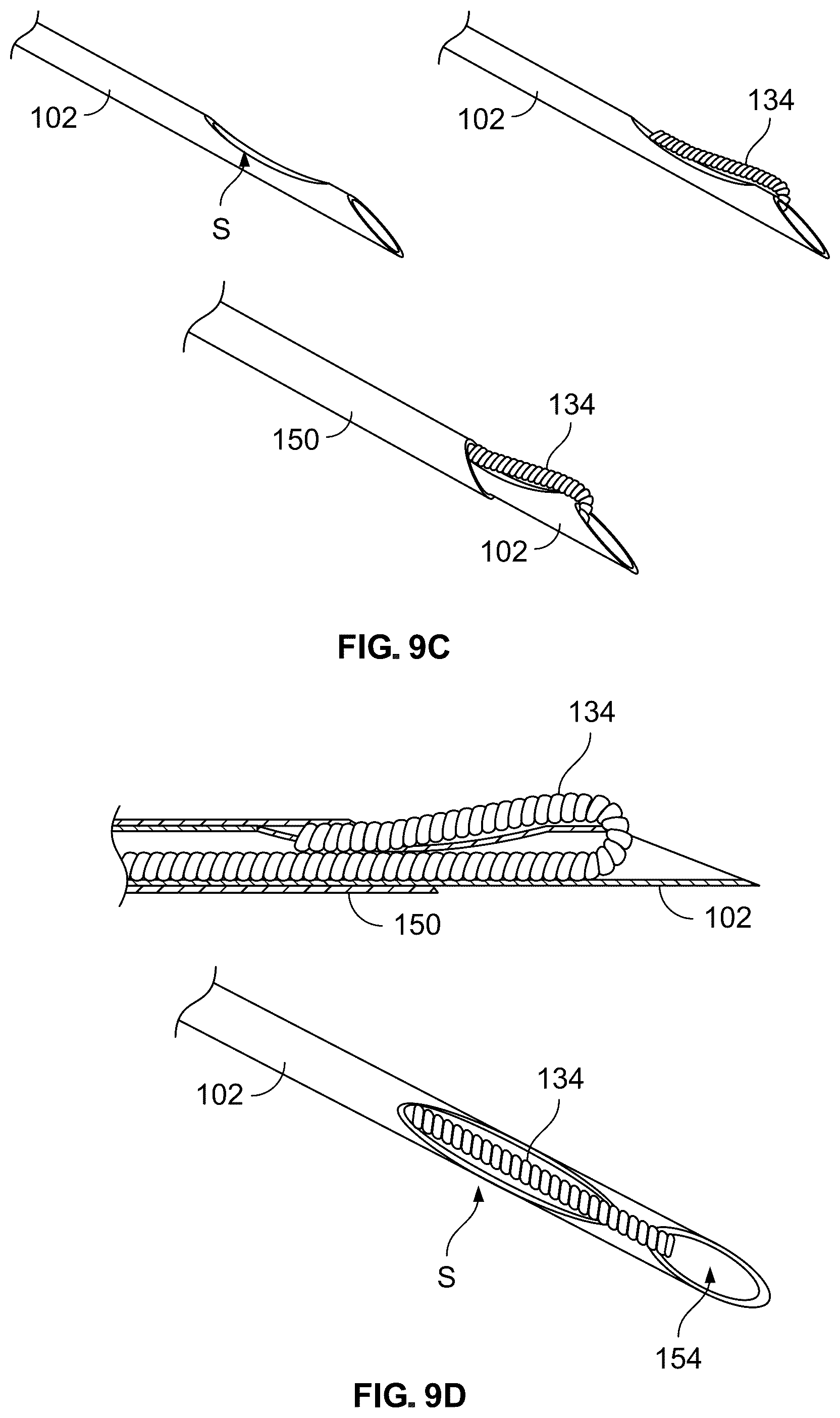 Patent US12318609 Figure 12 – Apparatus and method for positioning, implanting and using a stimulation lead