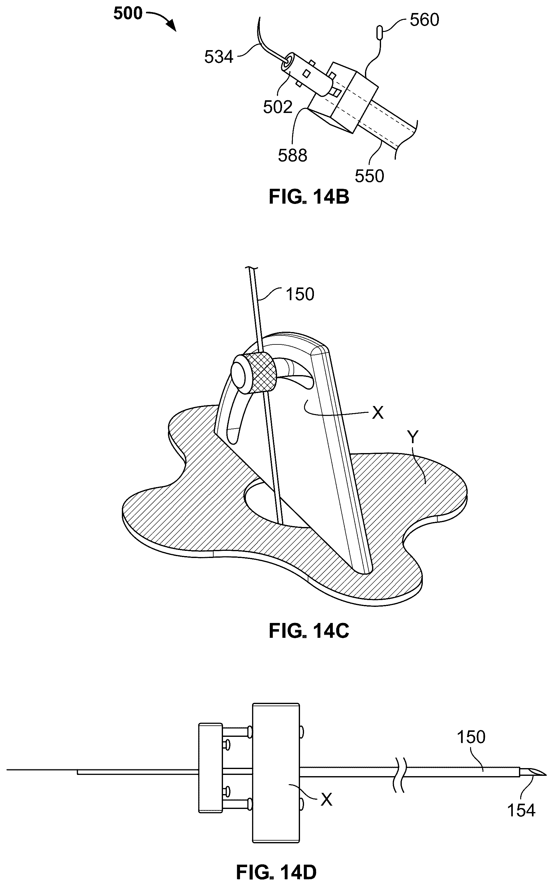 Patent US12318609 Figure 15 – Apparatus and method for positioning, implanting and using a stimulation lead