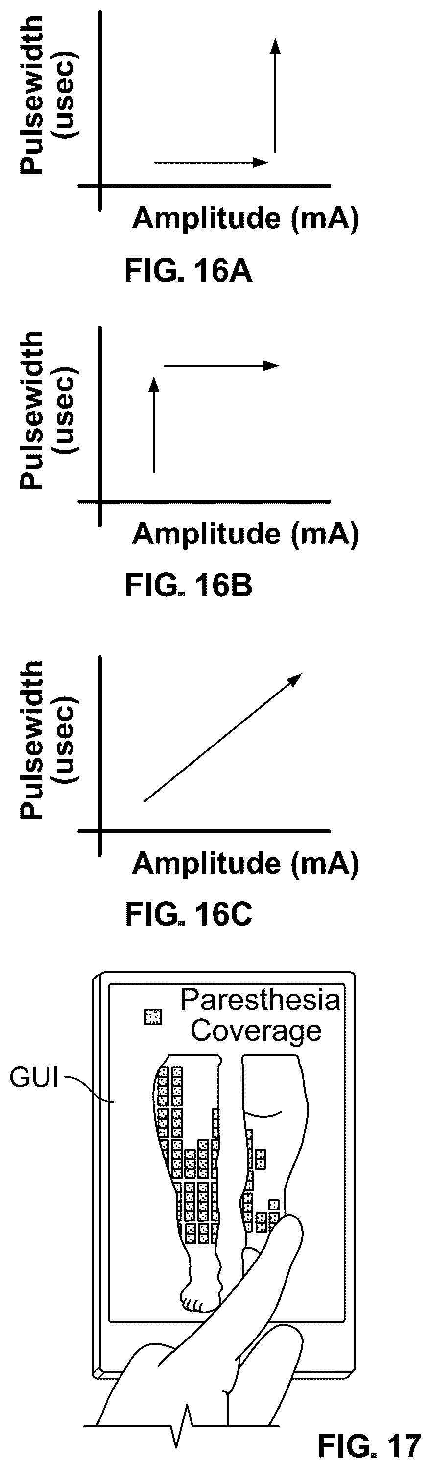 Patent US12318609 Figure 17 – Apparatus and method for positioning, implanting and using a stimulation lead