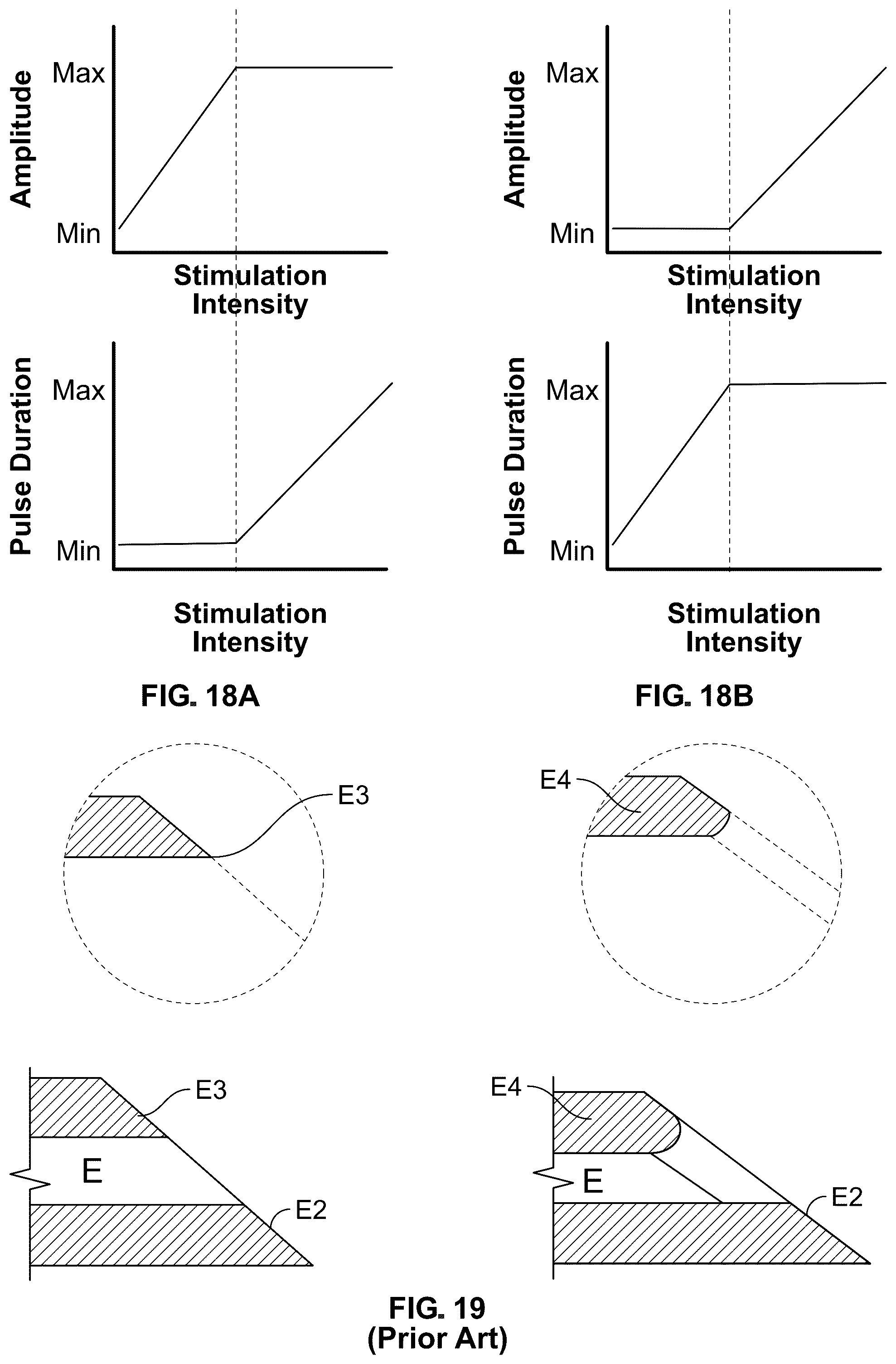 Patent US12318609 Figure 18 – Apparatus and method for positioning, implanting and using a stimulation lead