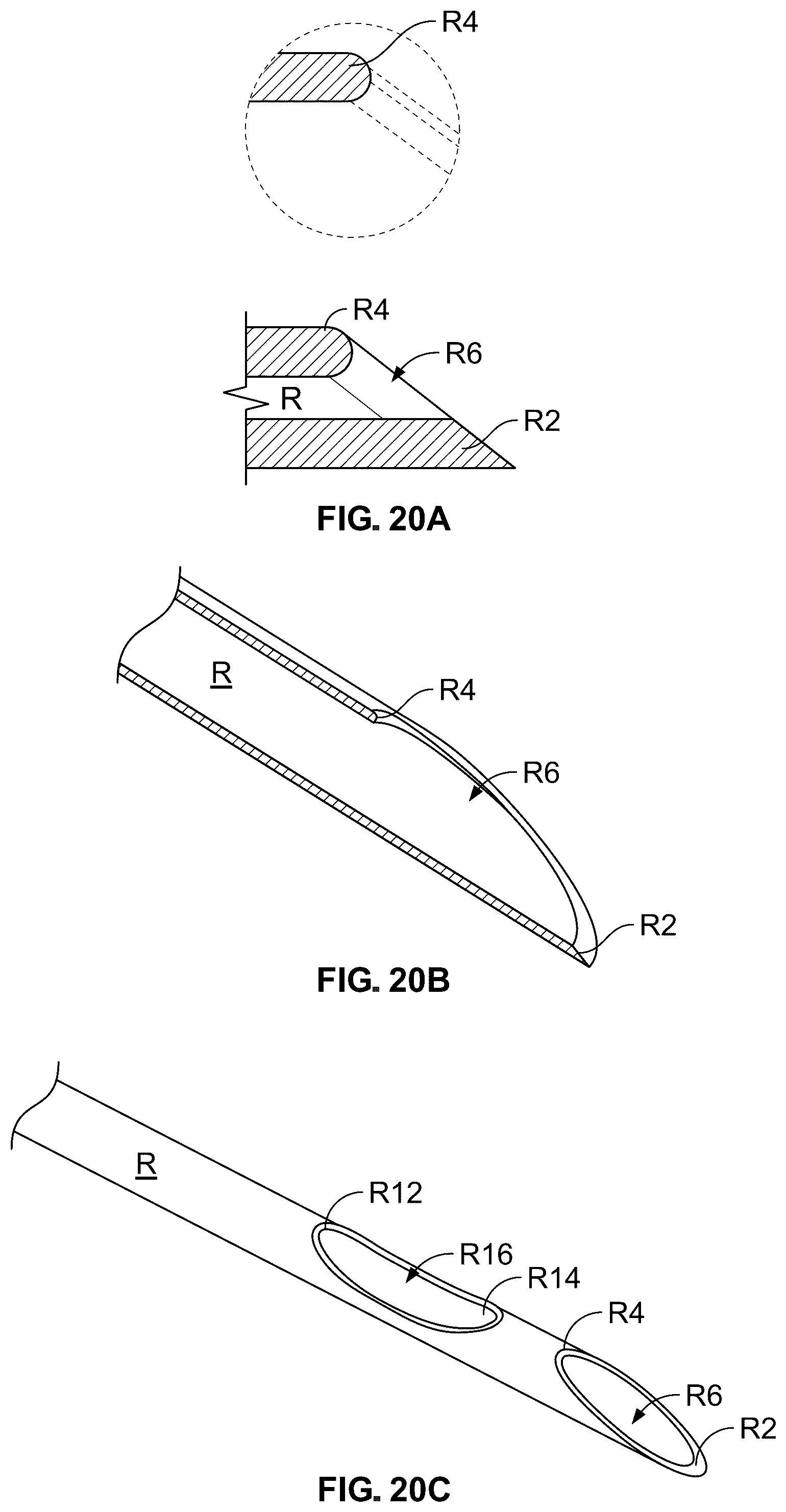 Patent US12318609 Figure 19 – Apparatus and method for positioning, implanting and using a stimulation lead