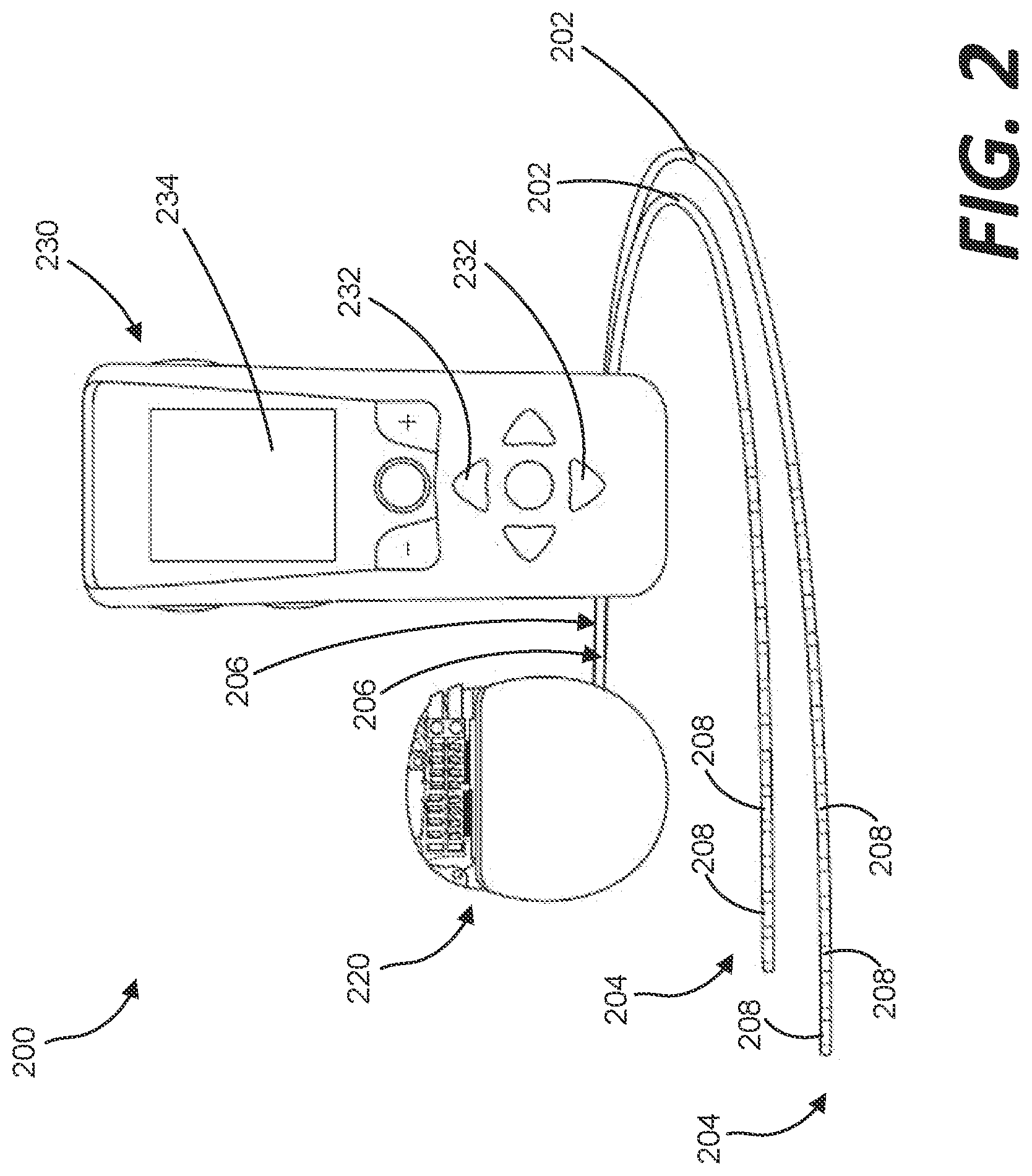 Patent US12318611 Figure 2 – Treating lung disease with spinal cord stimulation