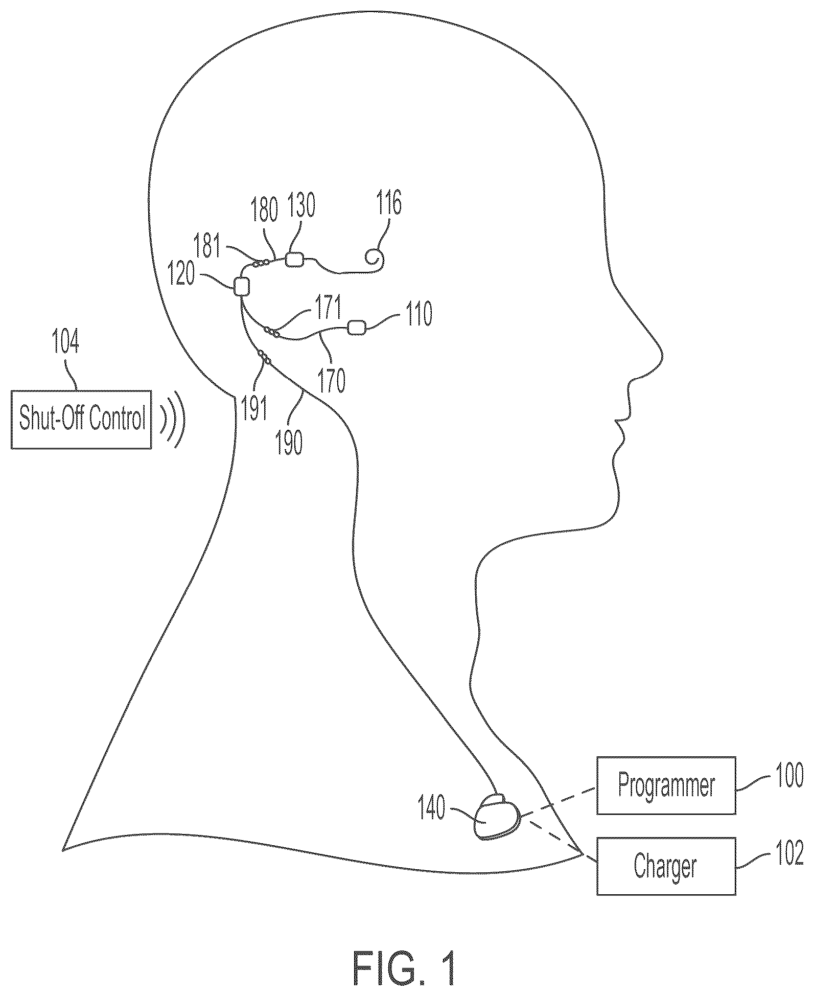 Patent US12318613 — Cochlear implant system with integrated signal analysis functionality — Figure 1