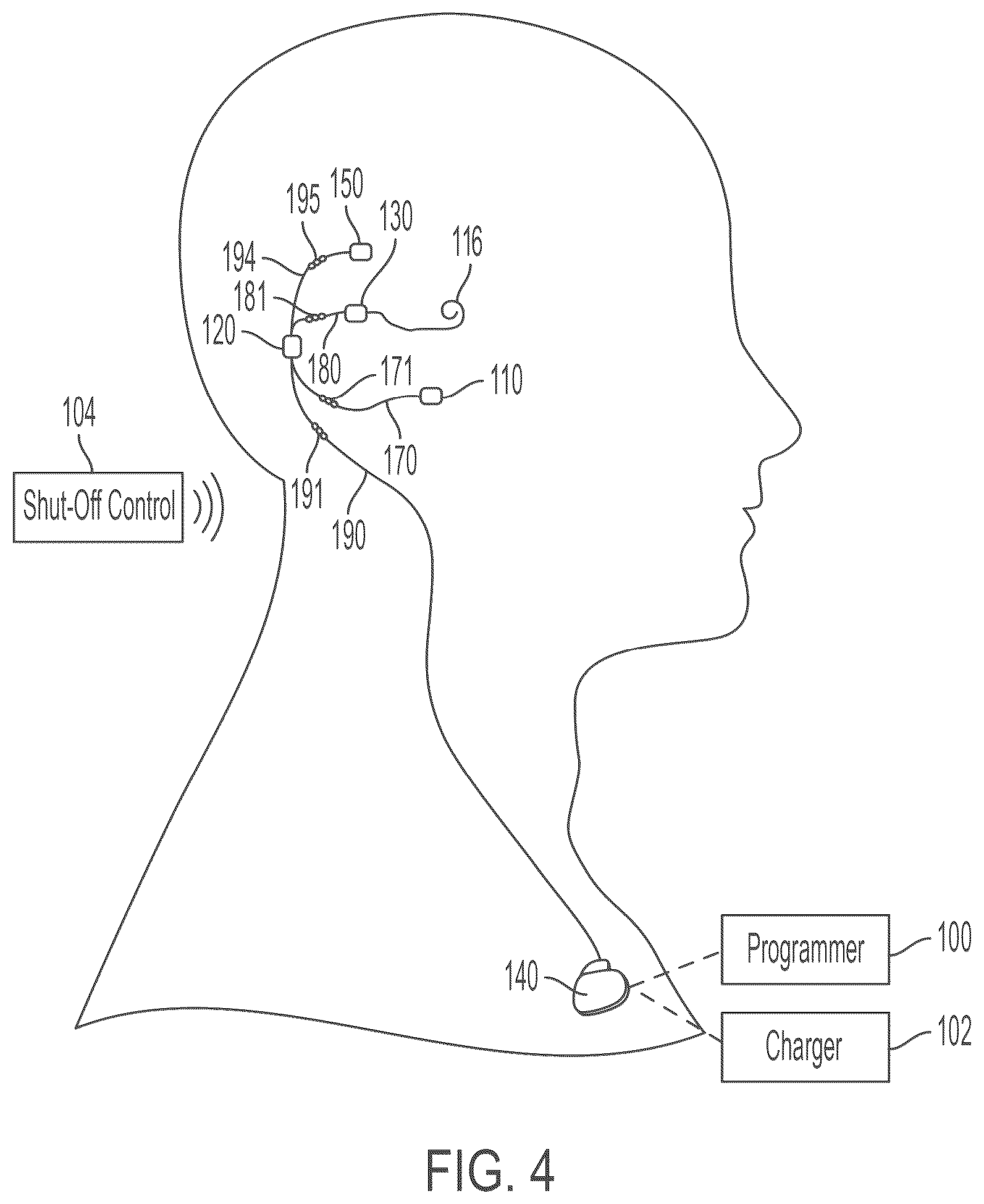 Patent US12318613 Figure 4 – Cochlear implant system with integrated signal analysis functionality