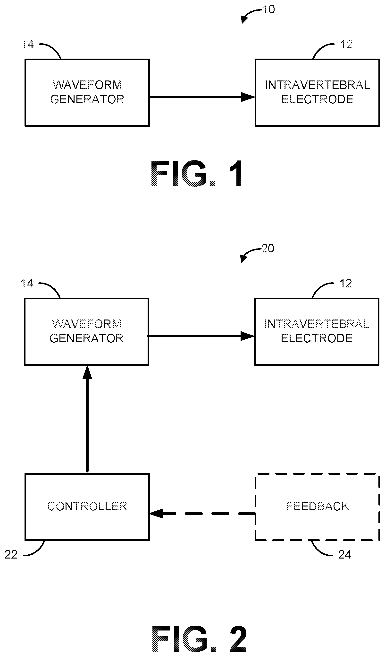 Patent US12318614 Figure 1 – Intravertebral direct current block of spinal transmission of neural signals