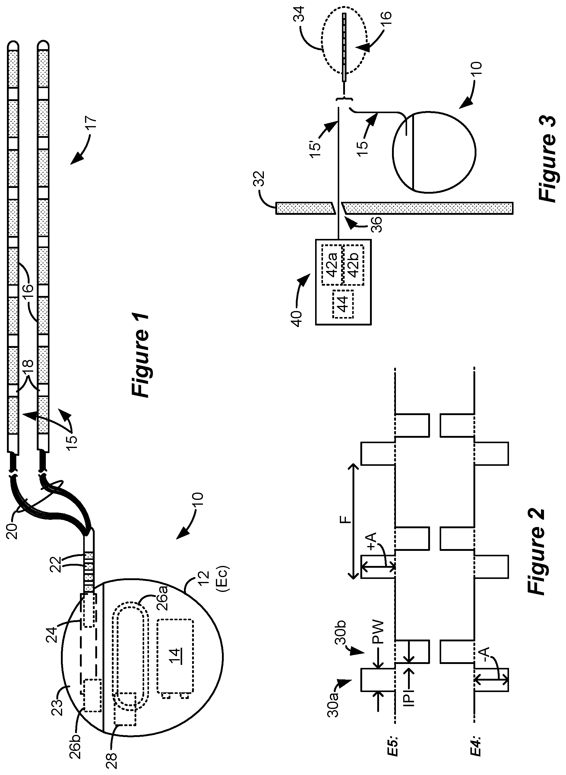 Patent US12318615 Figure 1 – Stimulation configuration variation to control evoked temporal patterns