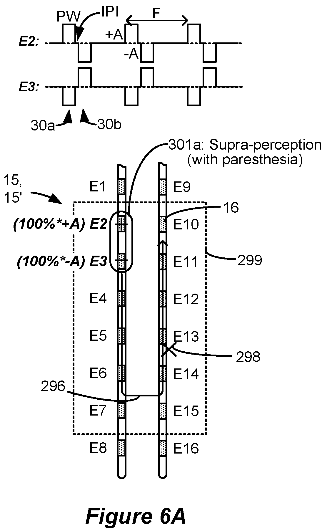 Patent US12318615 Figure 4 – Stimulation configuration variation to control evoked temporal patterns