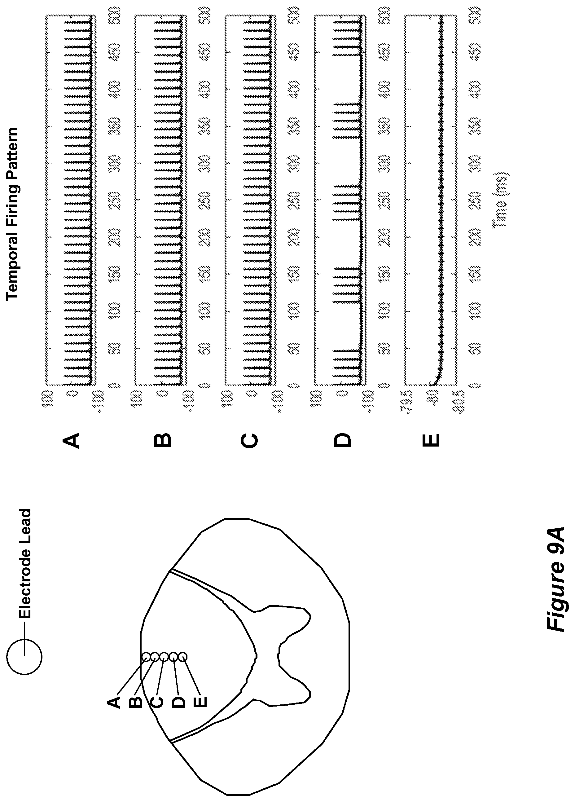Patent US12318615 Figure 10 – Stimulation configuration variation to control evoked temporal patterns