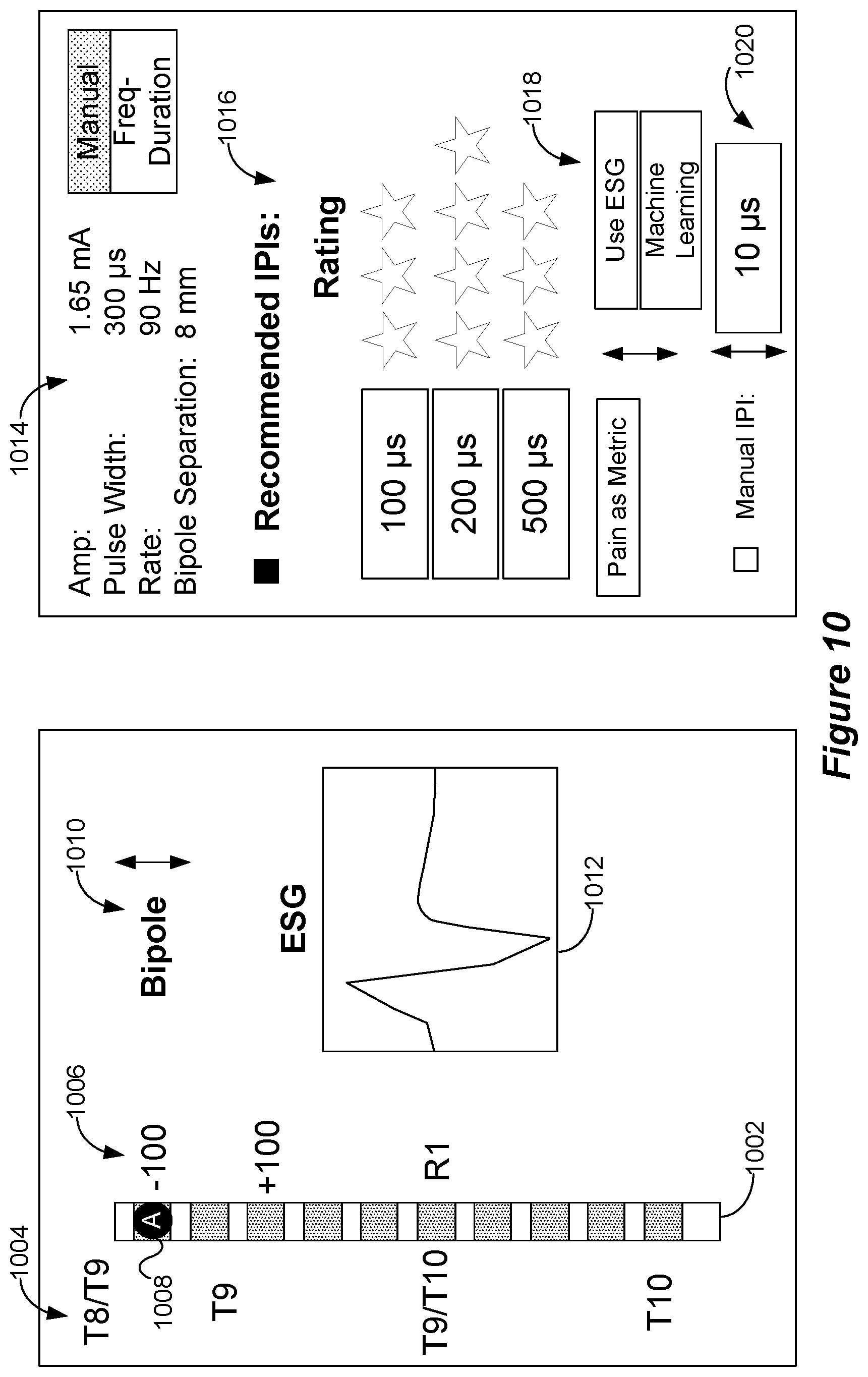 Patent US12318615 Figure 12 – Stimulation configuration variation to control evoked temporal patterns