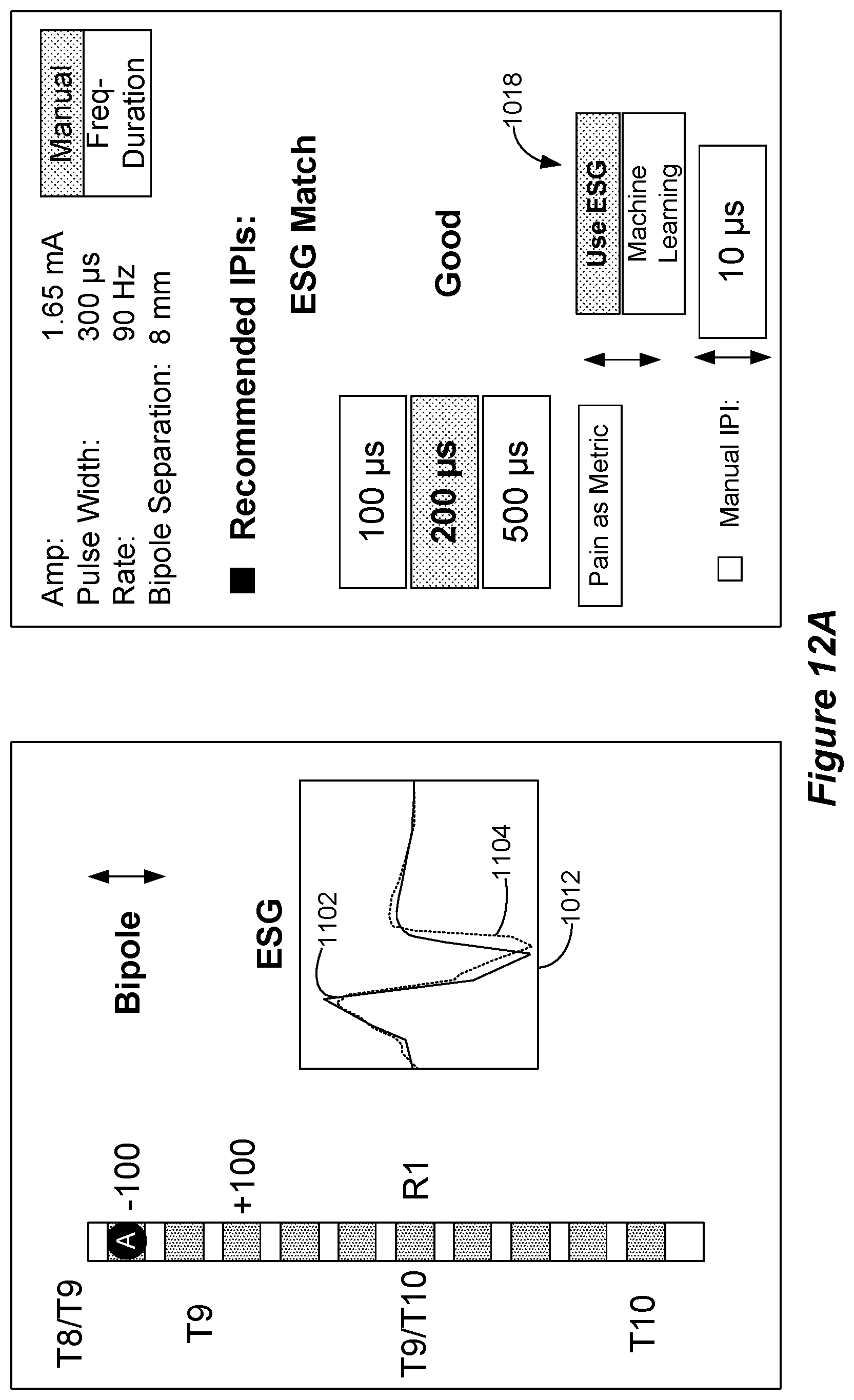 Patent US12318615 Figure 14 – Stimulation configuration variation to control evoked temporal patterns