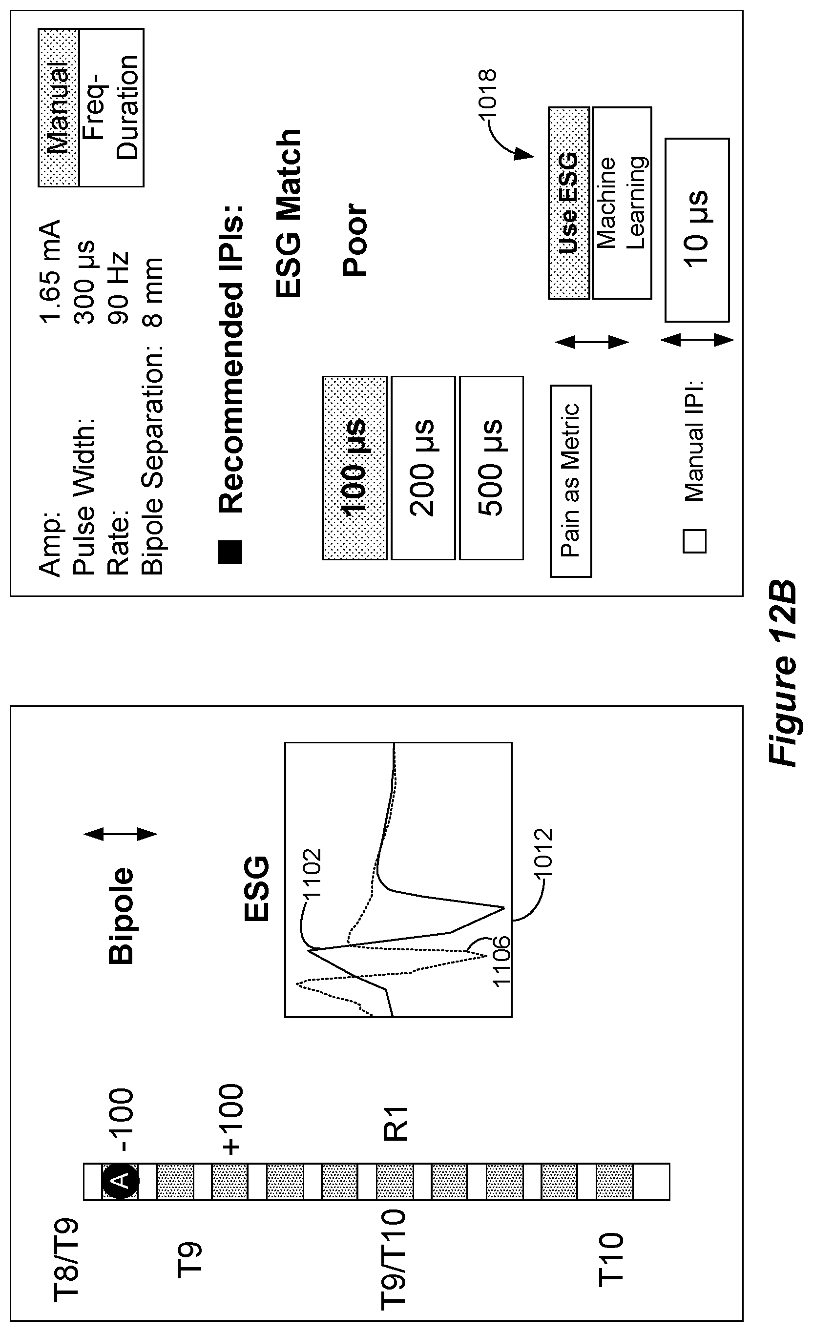 Patent US12318615 Figure 15 – Stimulation configuration variation to control evoked temporal patterns