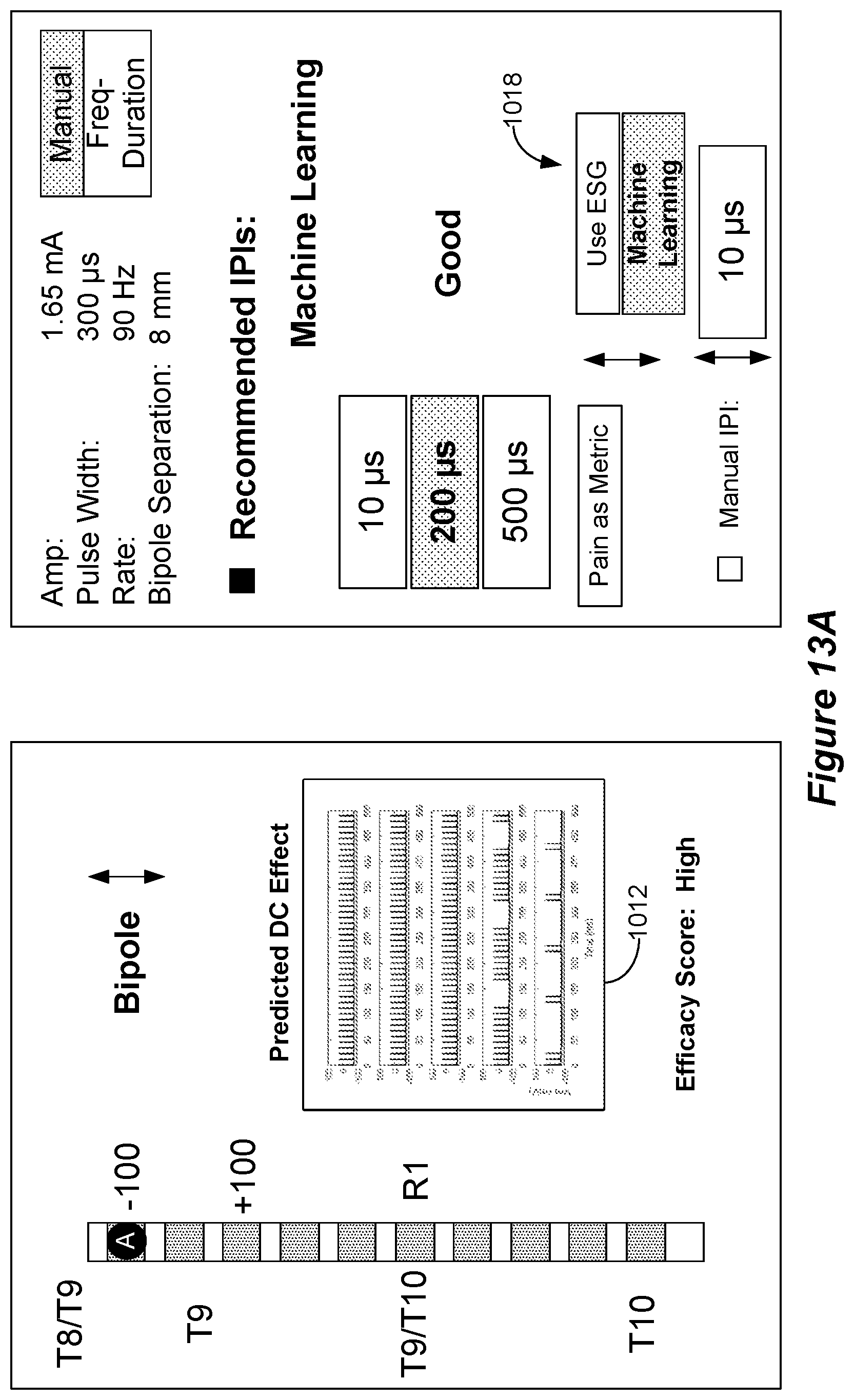 Patent US12318615 Figure 16 – Stimulation configuration variation to control evoked temporal patterns