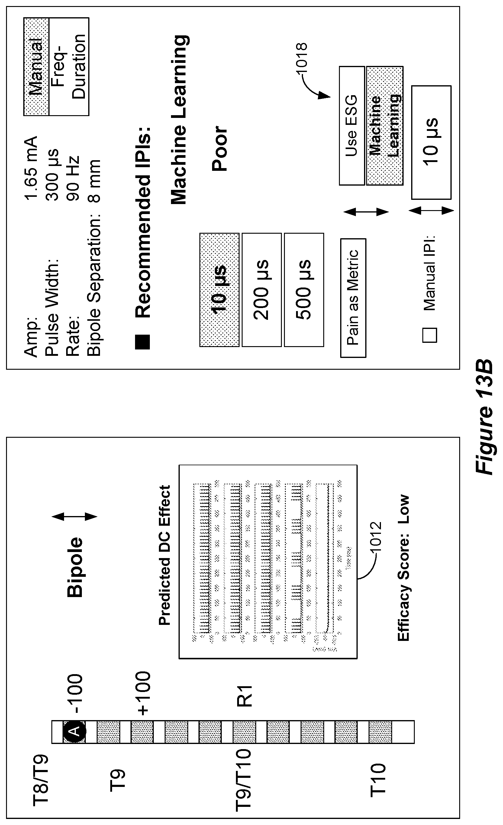 Patent US12318615 Figure 17 – Stimulation configuration variation to control evoked temporal patterns