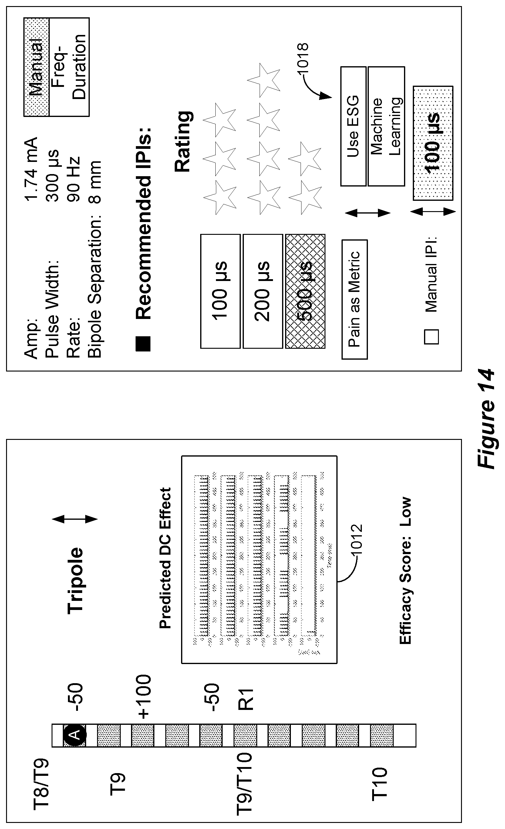 Patent US12318615 Figure 18 – Stimulation configuration variation to control evoked temporal patterns