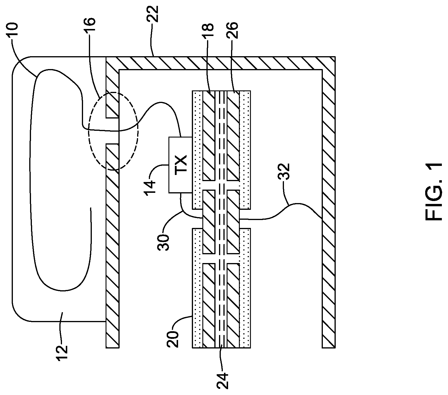 Patent US12318618 Figure 1 – Implantable medical device with feedthrough antenna ground structure