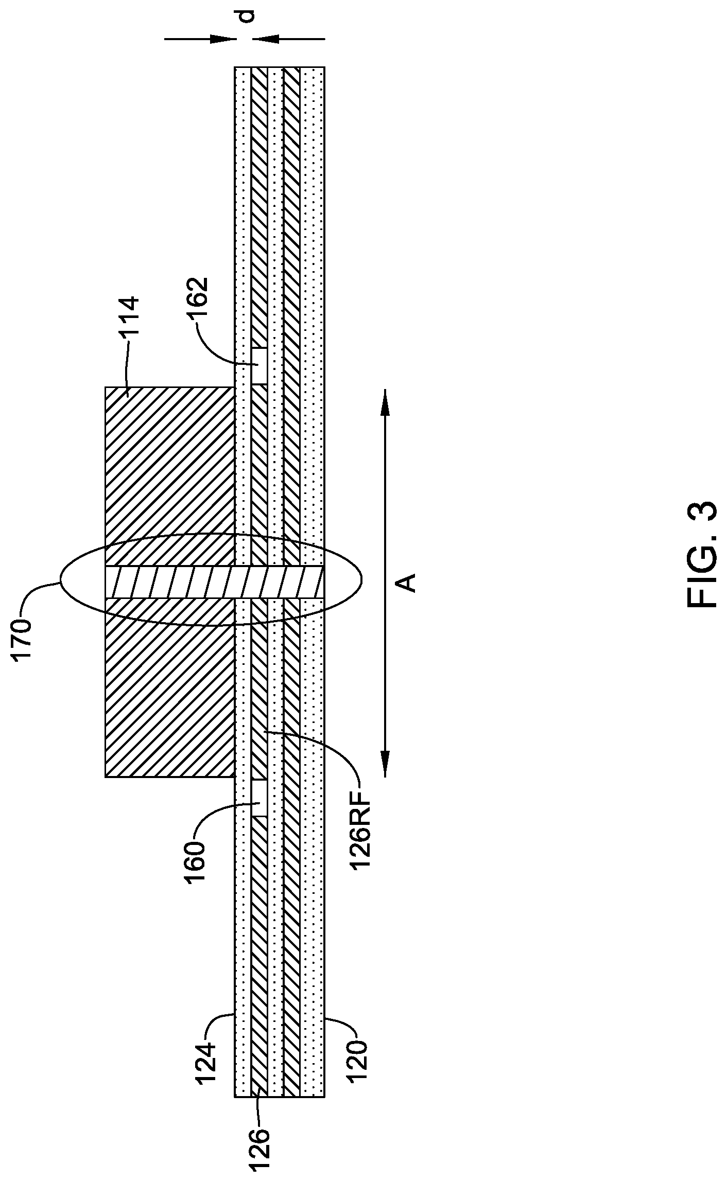 Patent US12318618 Figure 3 – Implantable medical device with feedthrough antenna ground structure