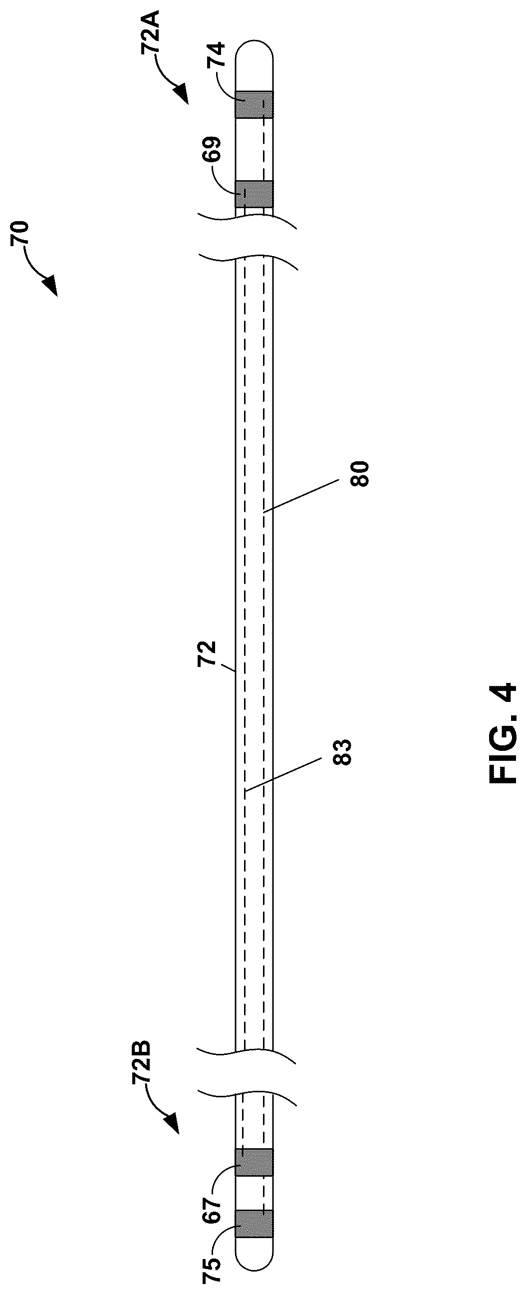 Patent US12318619 Figure 4 – Medical leads and techniques for manufacturing the same