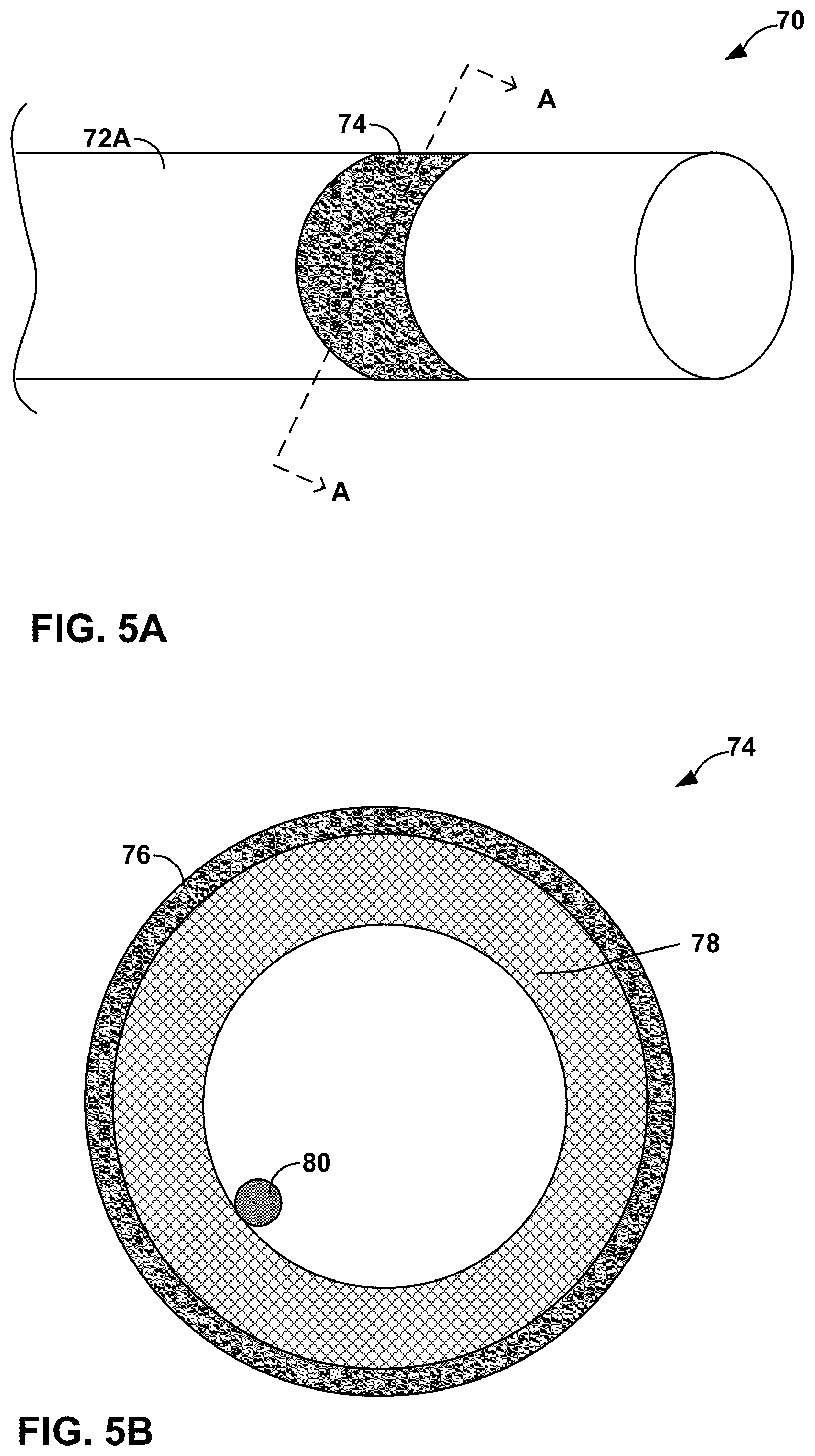 Patent US12318619 Figure 5 – Medical leads and techniques for manufacturing the same