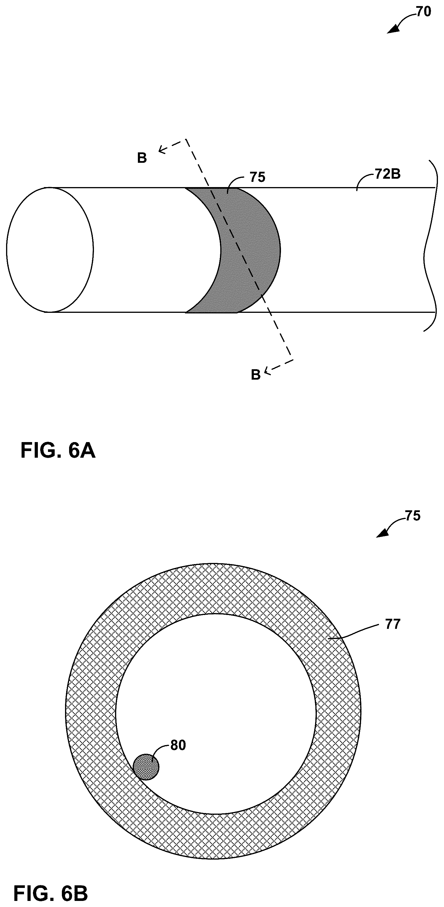 Patent US12318619 Figure 6 – Medical leads and techniques for manufacturing the same