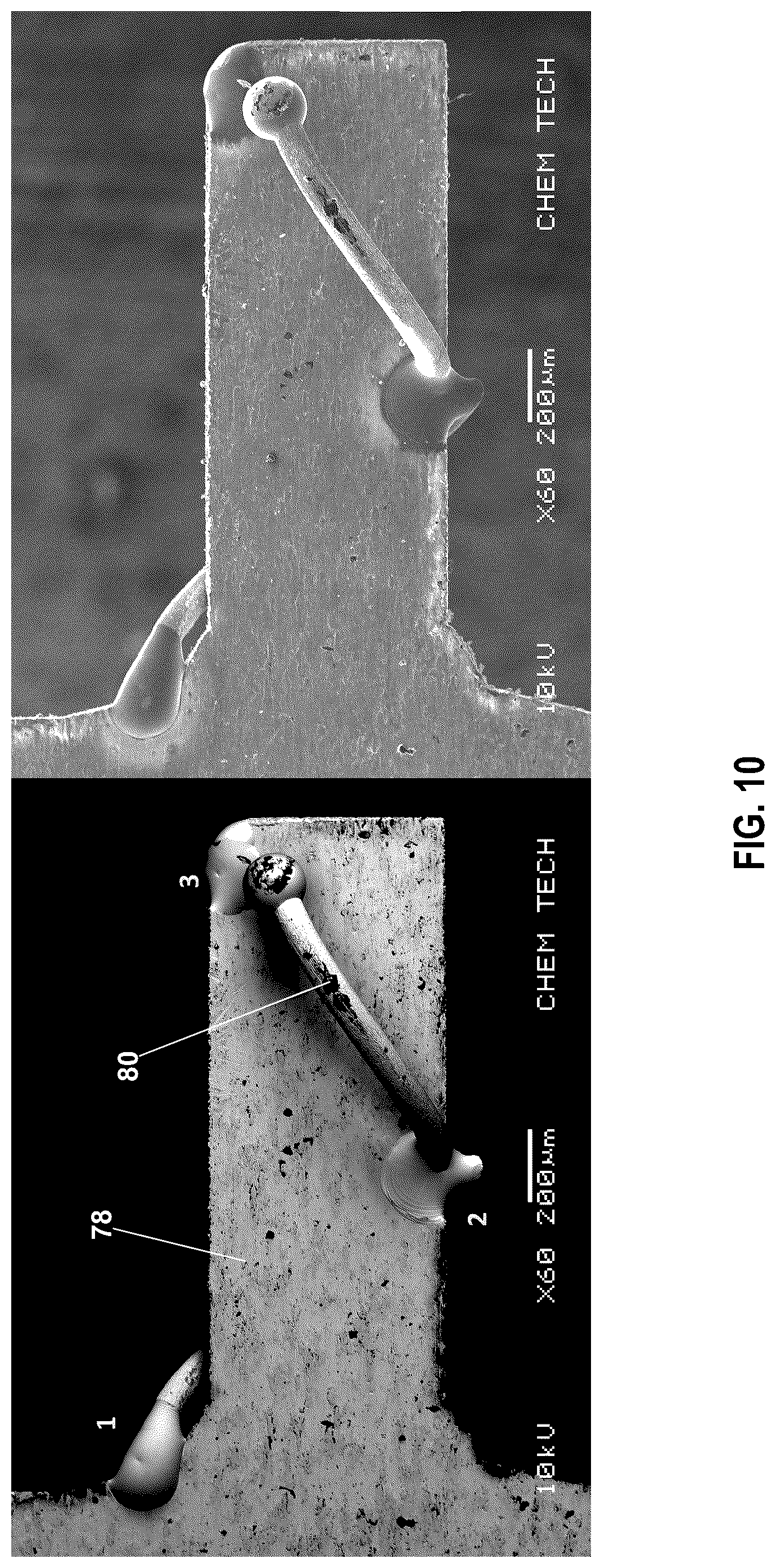 Patent US12318619 Figure 10 – Medical leads and techniques for manufacturing the same