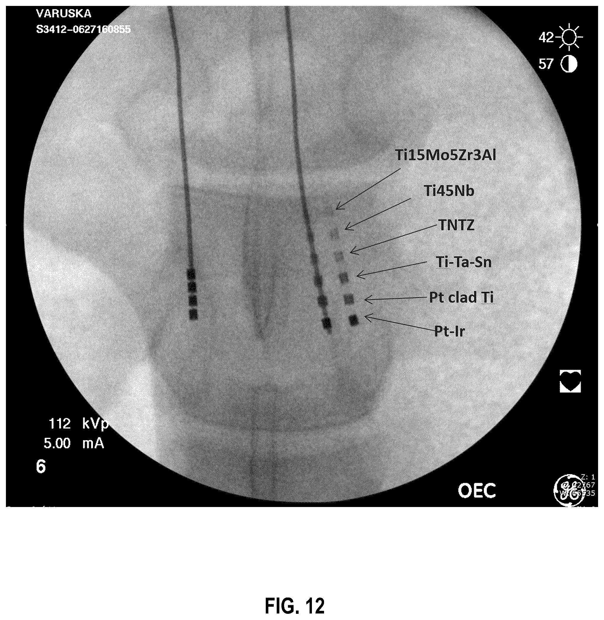 Patent US12318619 Figure 12 – Medical leads and techniques for manufacturing the same