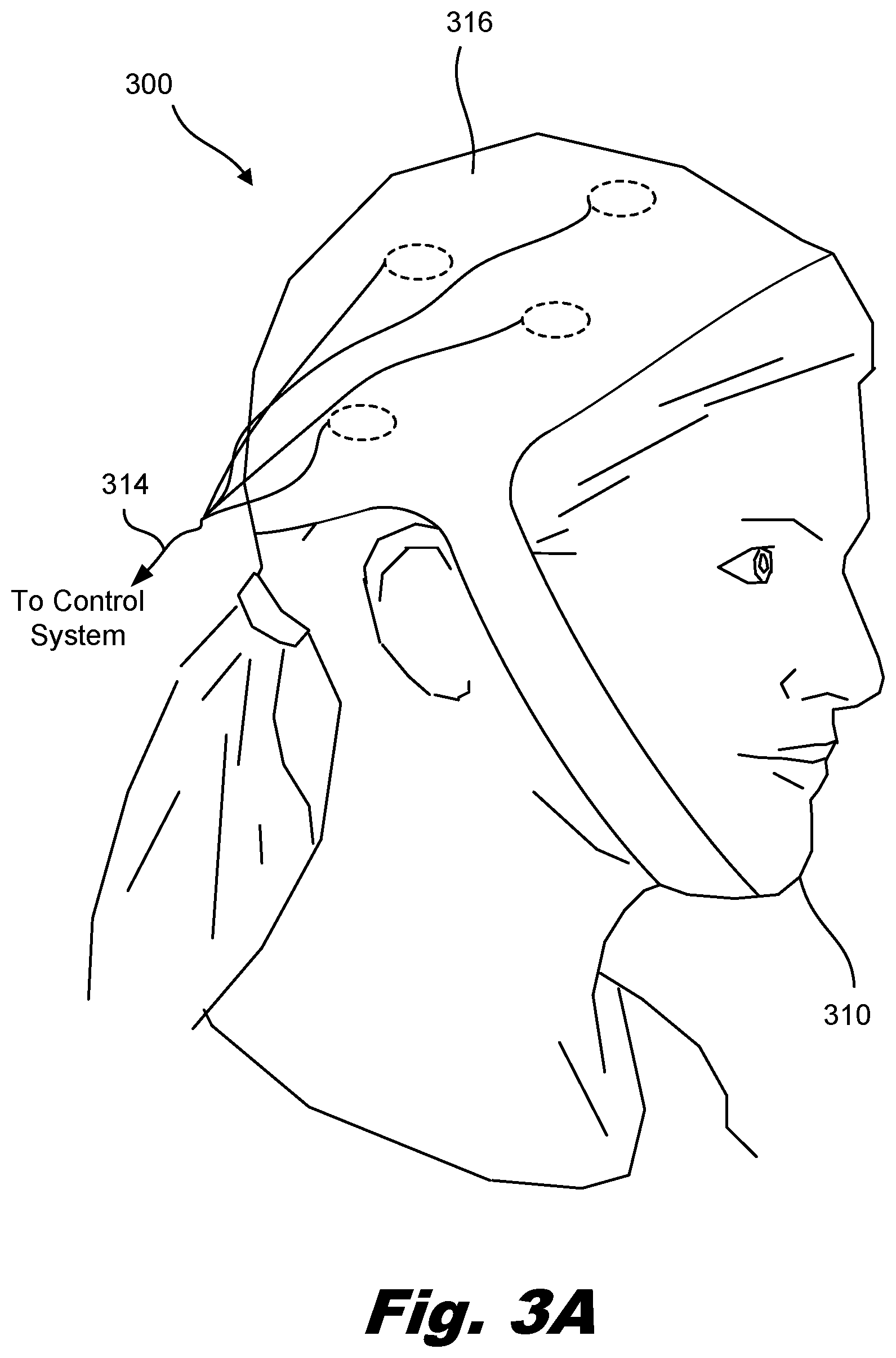 Patent US12318624 Figure 3 – Brain immunoregulation through transcranial electromagnetic treatment