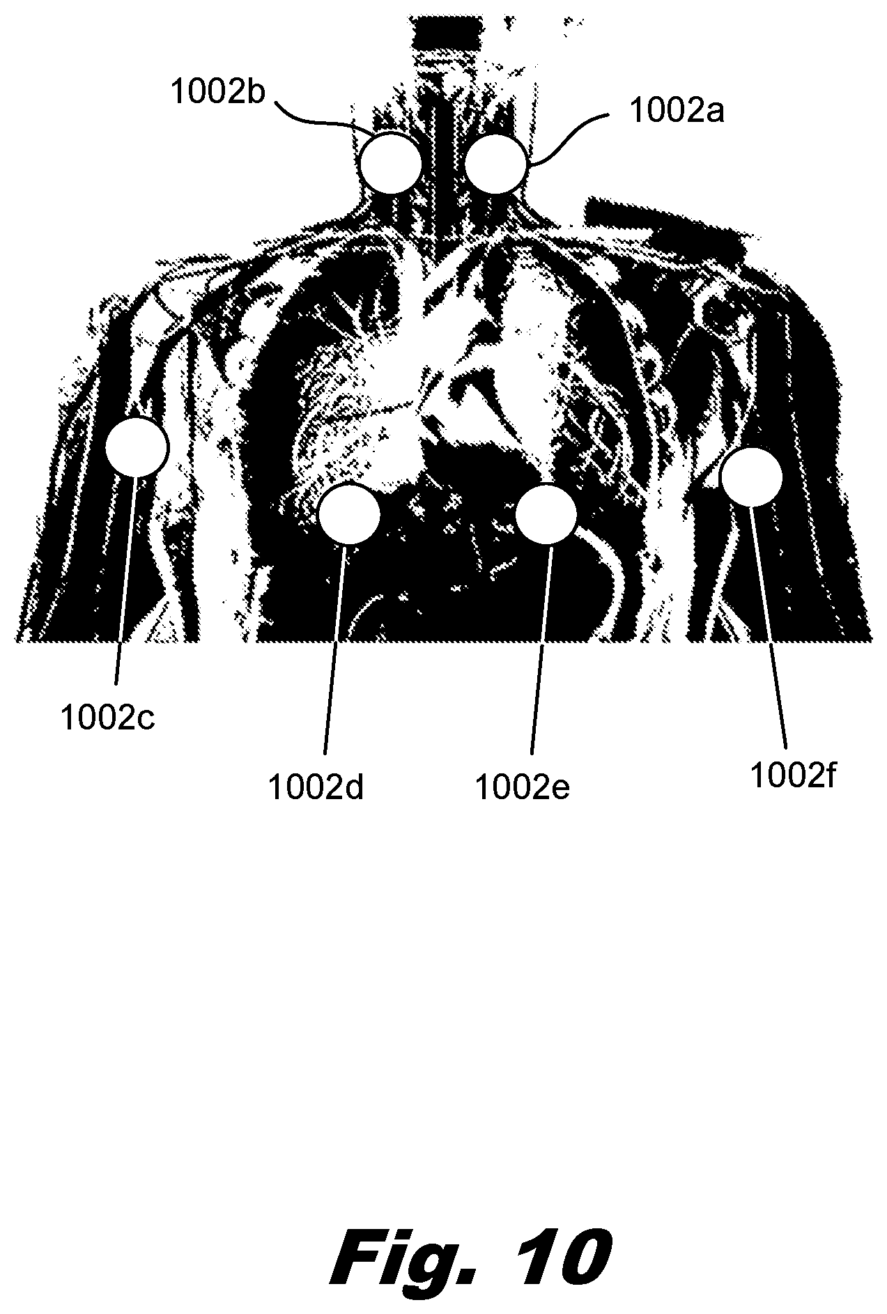 Patent US12318624 Figure 9 – Brain immunoregulation through transcranial electromagnetic treatment