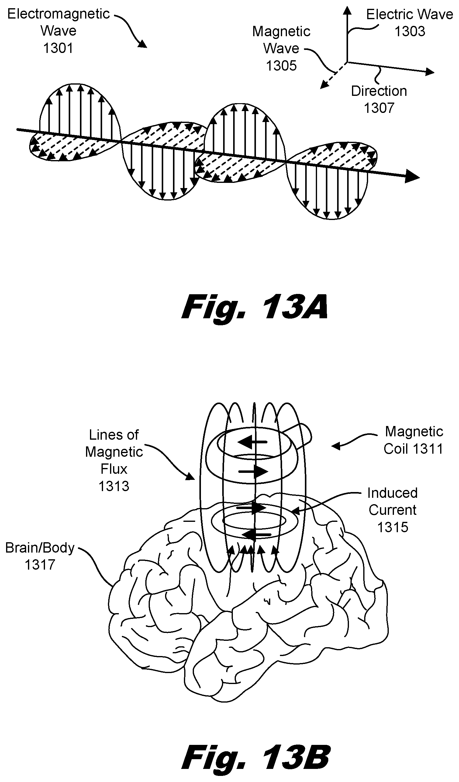 Patent US12318624 Figure 12 – Brain immunoregulation through transcranial electromagnetic treatment