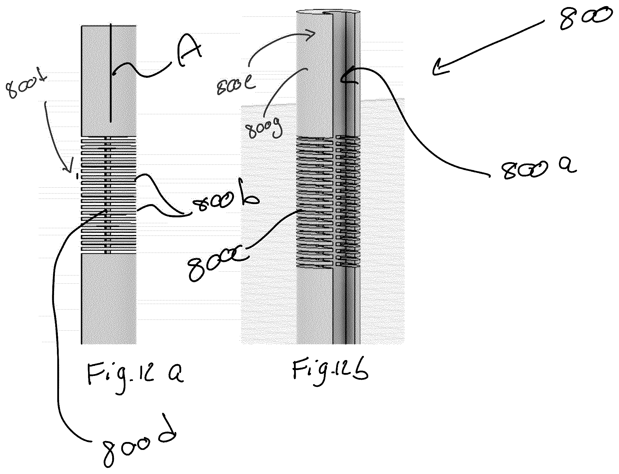 Patent US12318629 Figure 11 – Radiation shields for brachytherapy