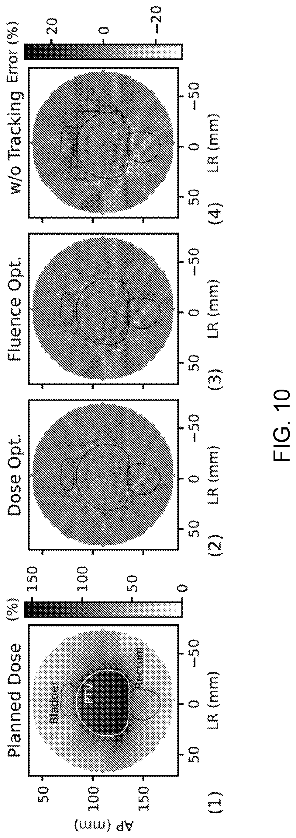 Patent US12318631 Figure 10 – Dose-based optimization for multi-leaf collimator (“MLC”) tracking during radiation therapy methods and apparatus