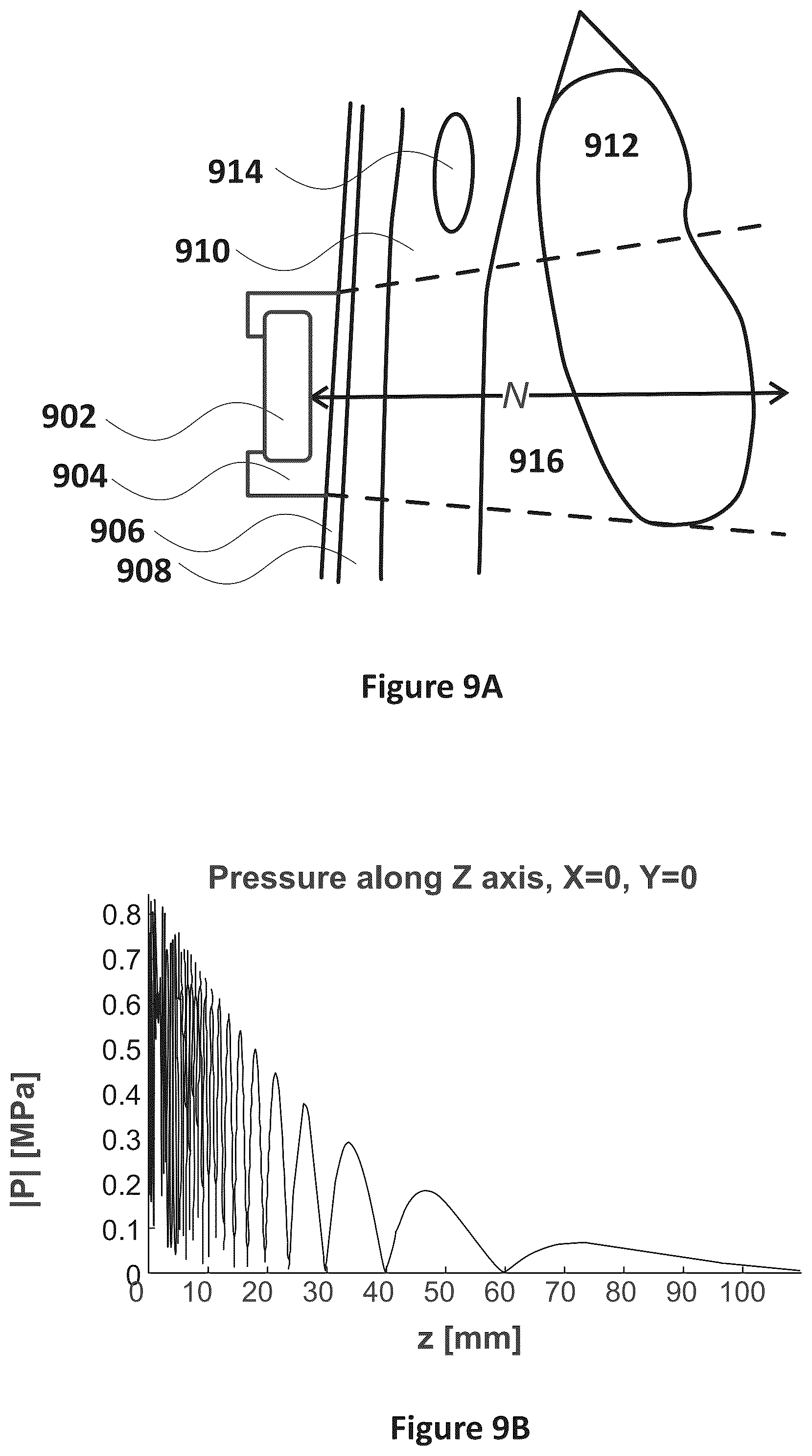 Patent US12318635 Figure 5 – Apparatus and method for treating kidneys
