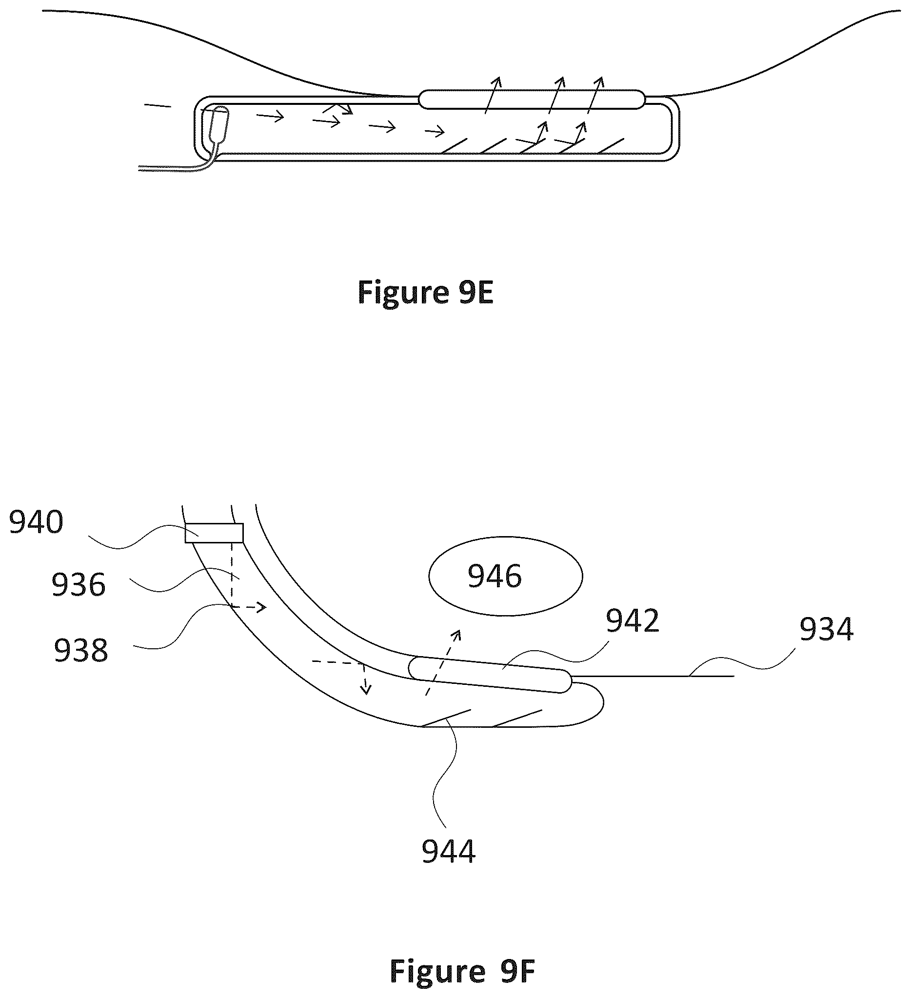 Patent US12318635 Figure 7 – Apparatus and method for treating kidneys