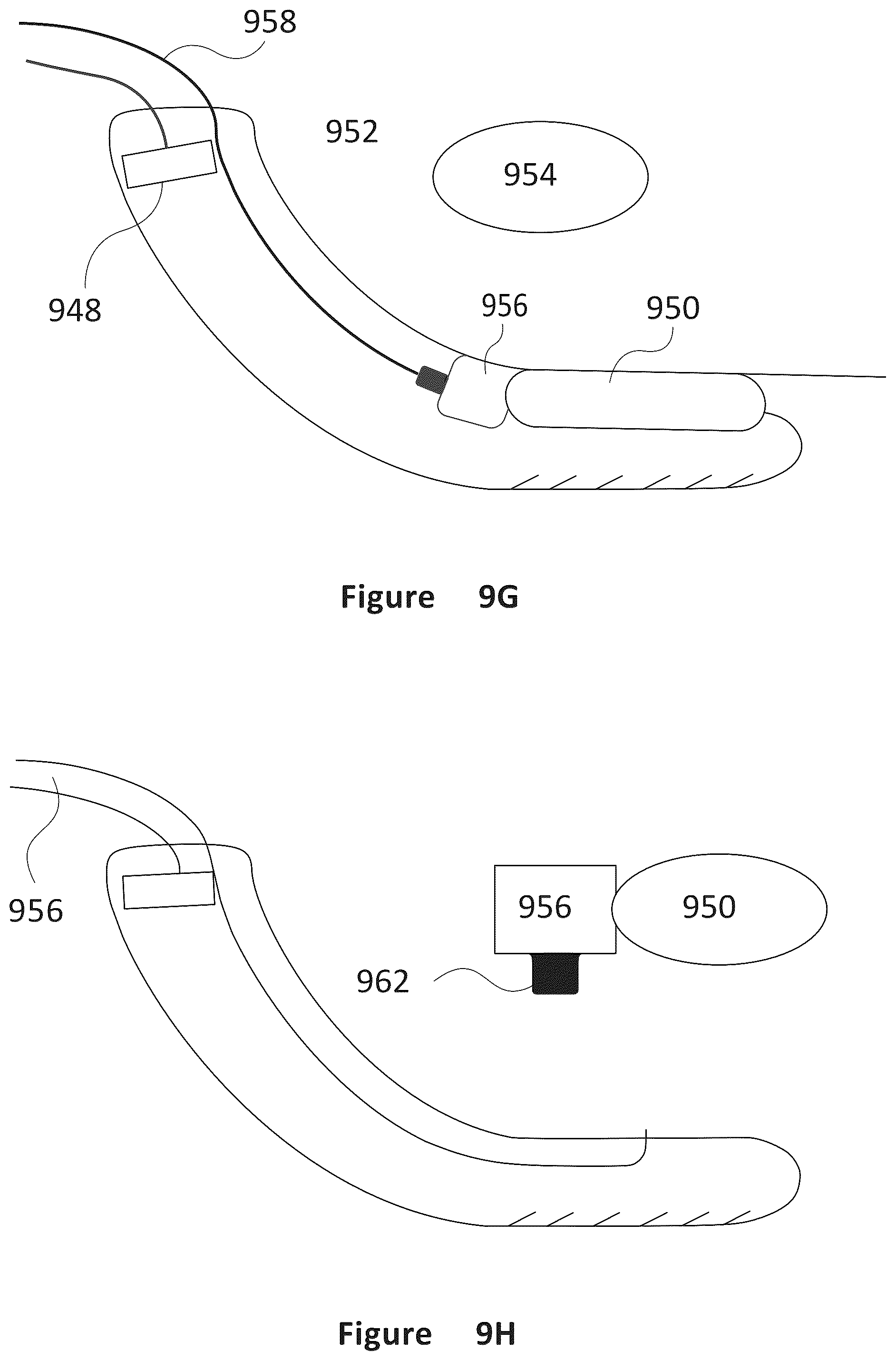 Patent US12318635 Figure 8 – Apparatus and method for treating kidneys
