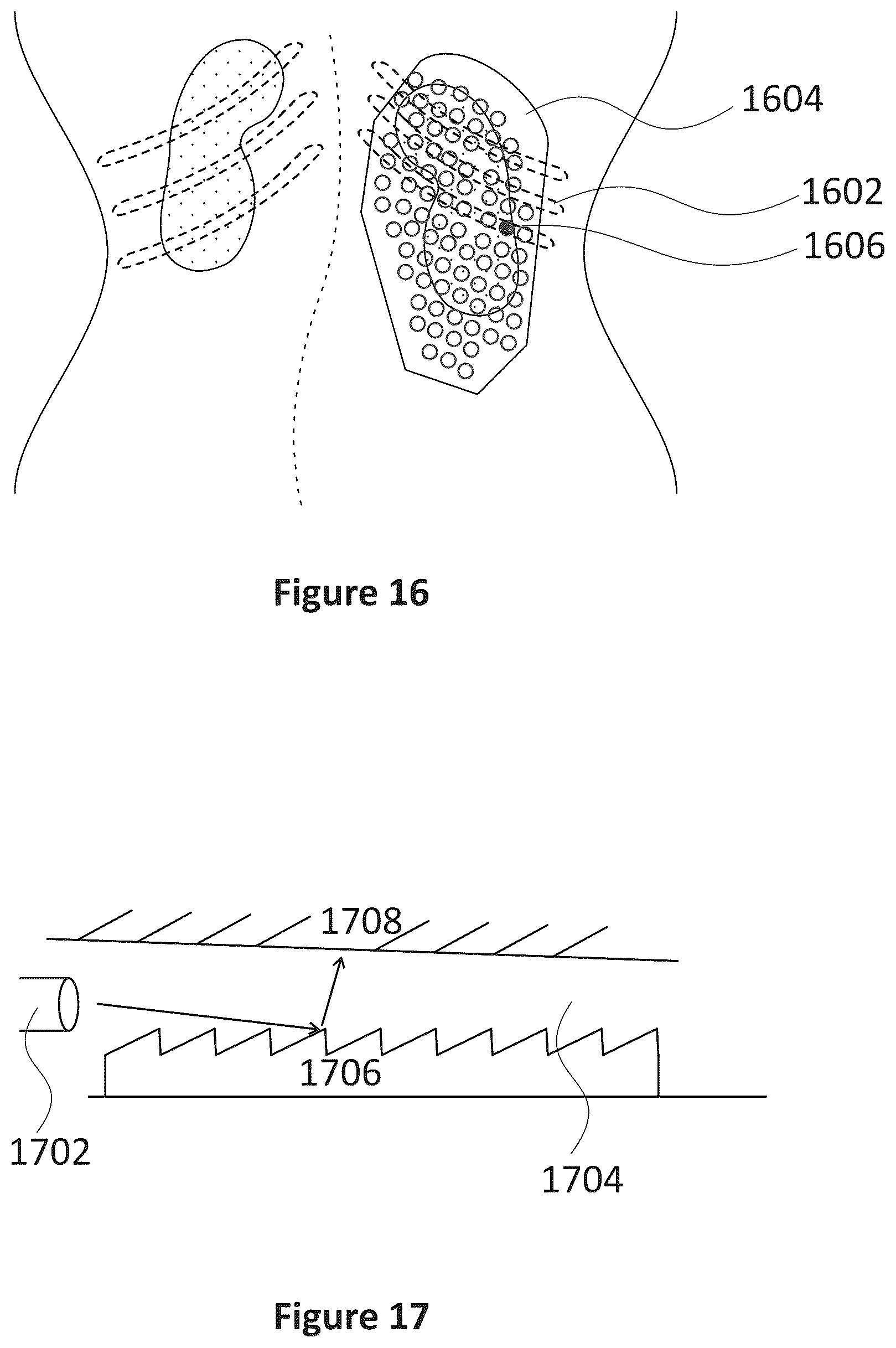 Patent US12318635 Figure 13 – Apparatus and method for treating kidneys