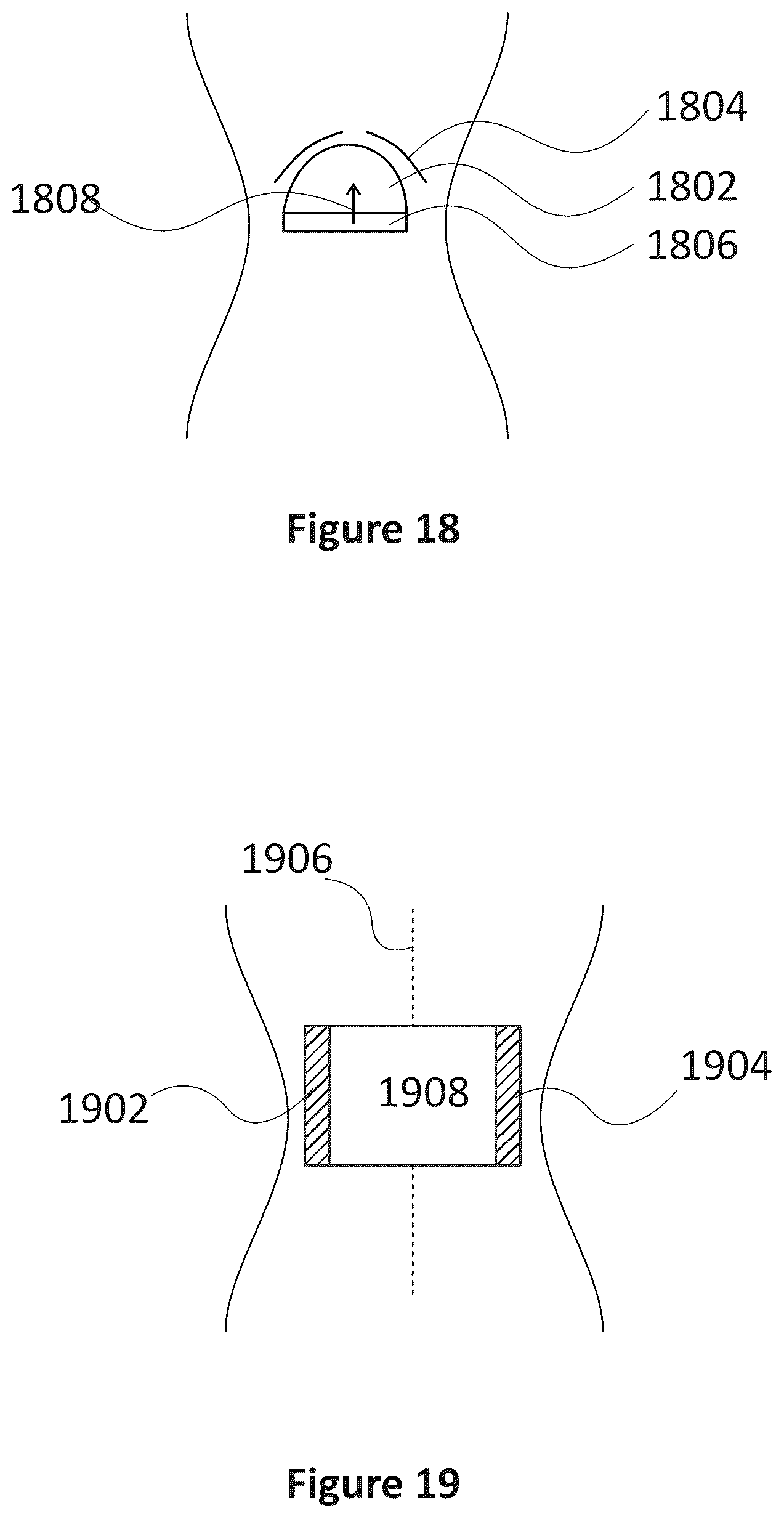 Patent US12318635 Figure 14 – Apparatus and method for treating kidneys
