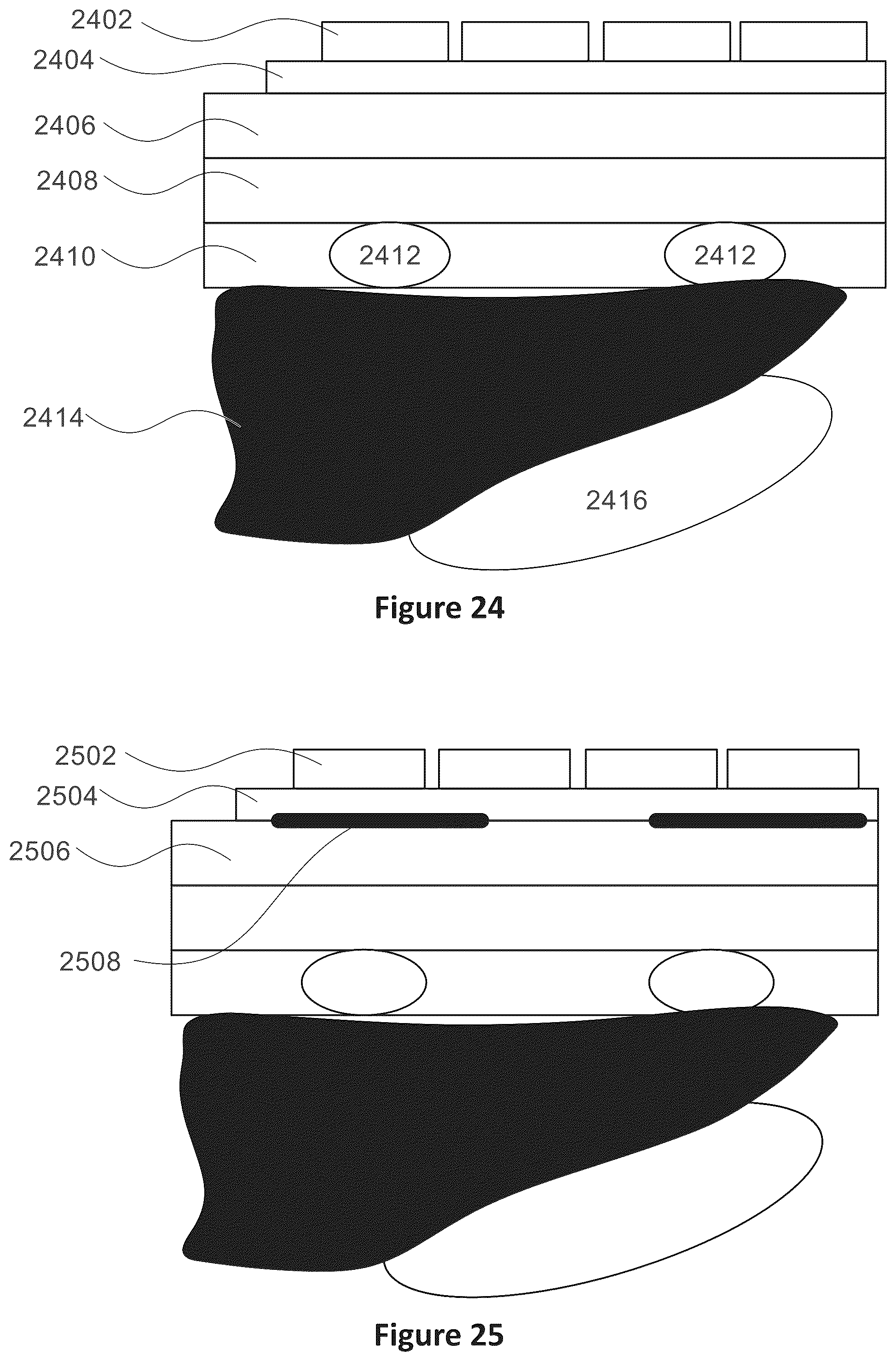 Patent US12318635 Figure 17 – Apparatus and method for treating kidneys