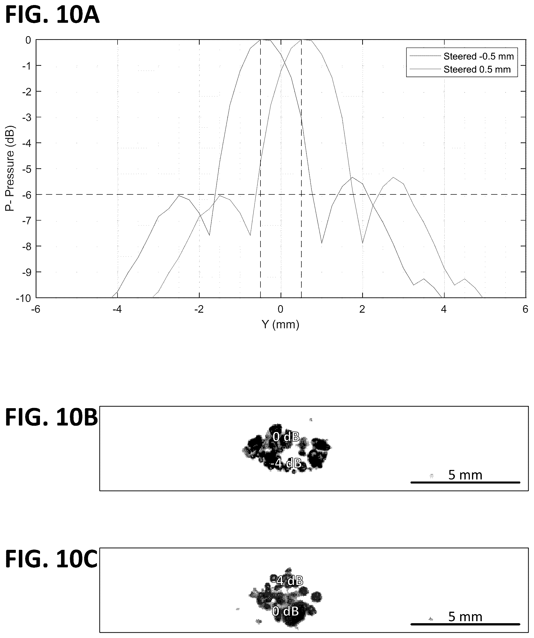 Patent US12318636 Figure 11 – Histotripsy systems and methods