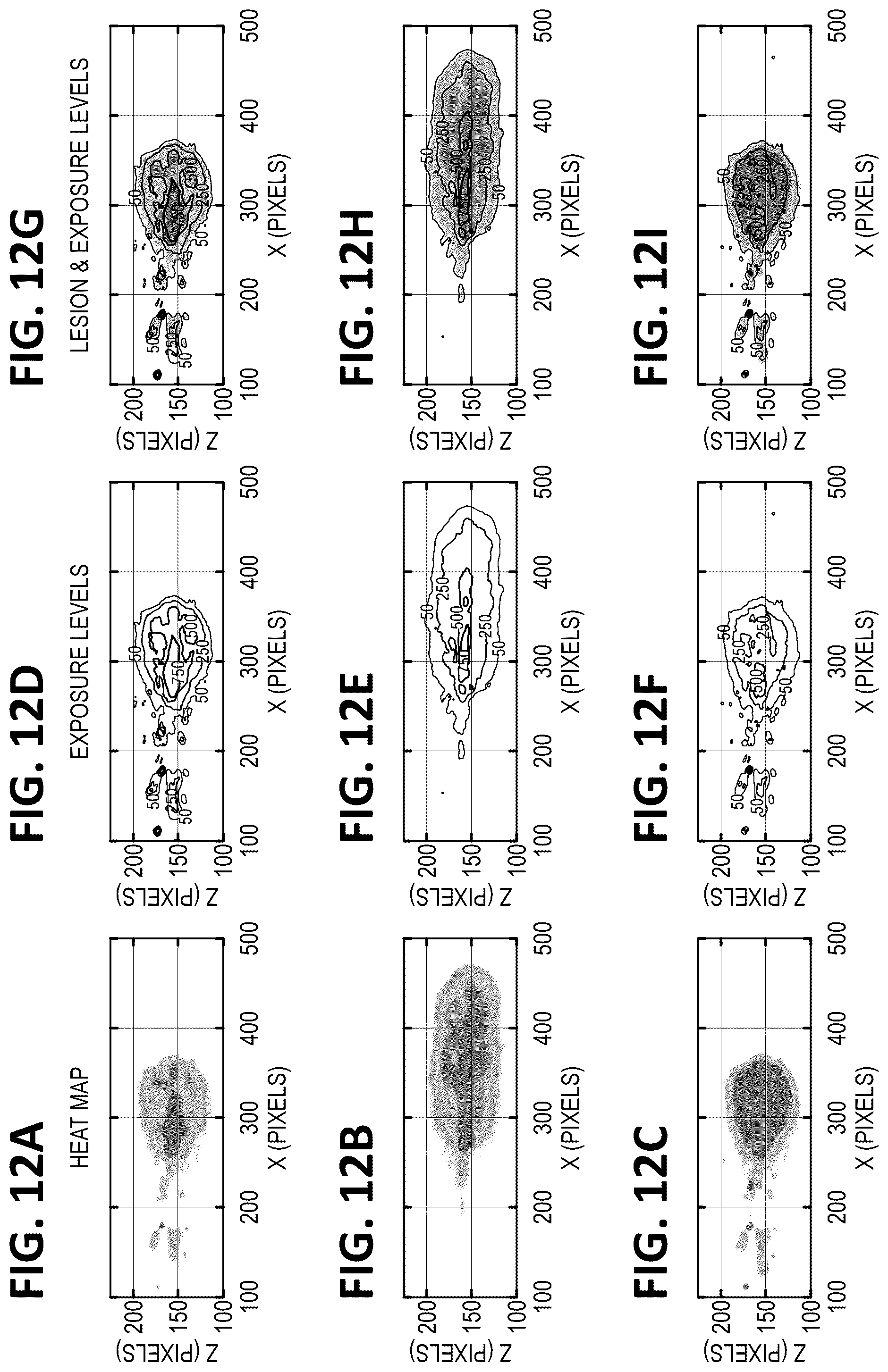Patent US12318636 Figure 13 – Histotripsy systems and methods